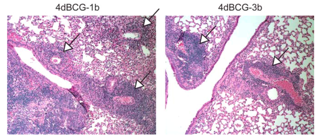 Vaccines 01 00034 g007 1024