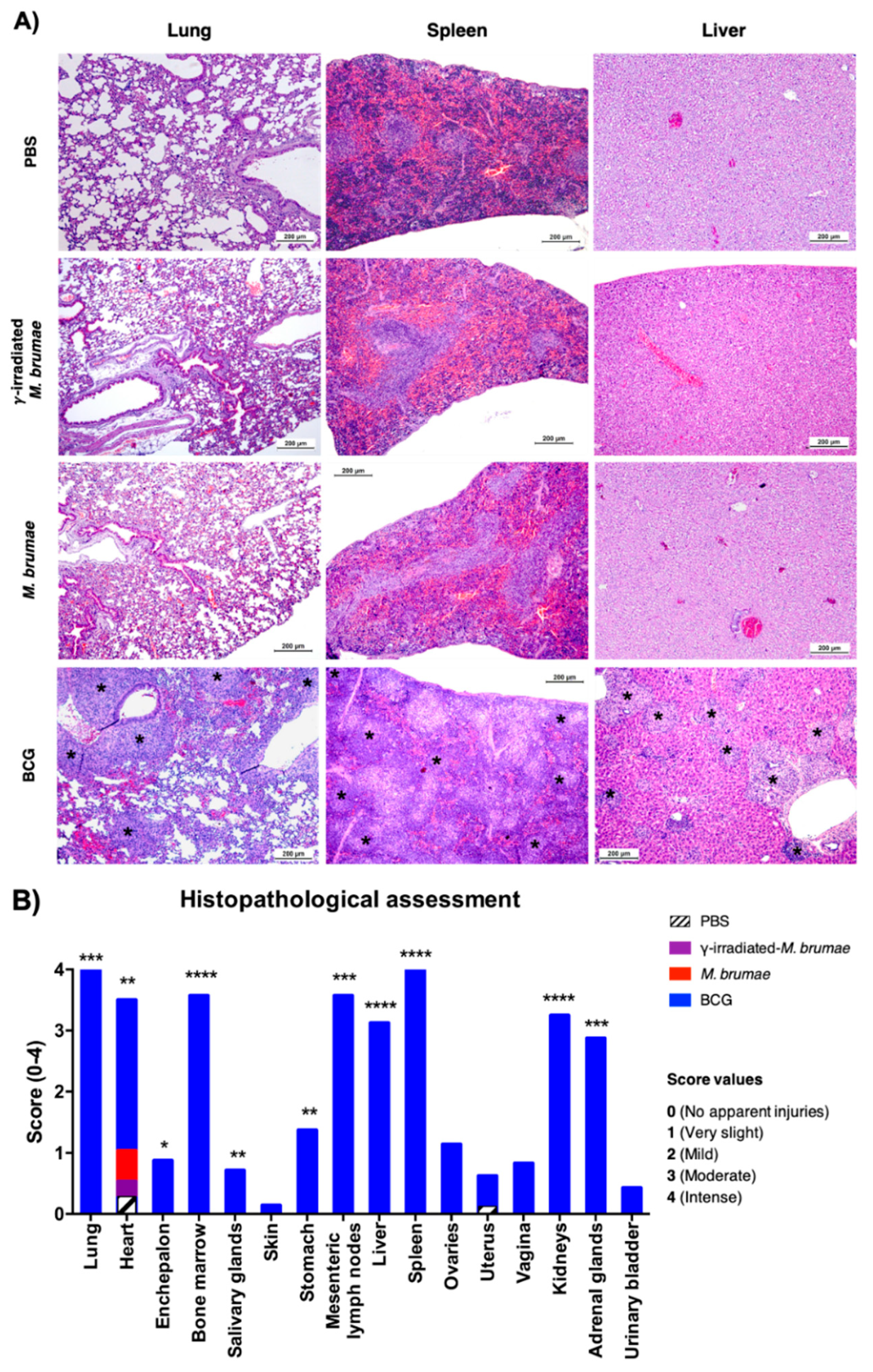 Vaccines 08 00198 g004