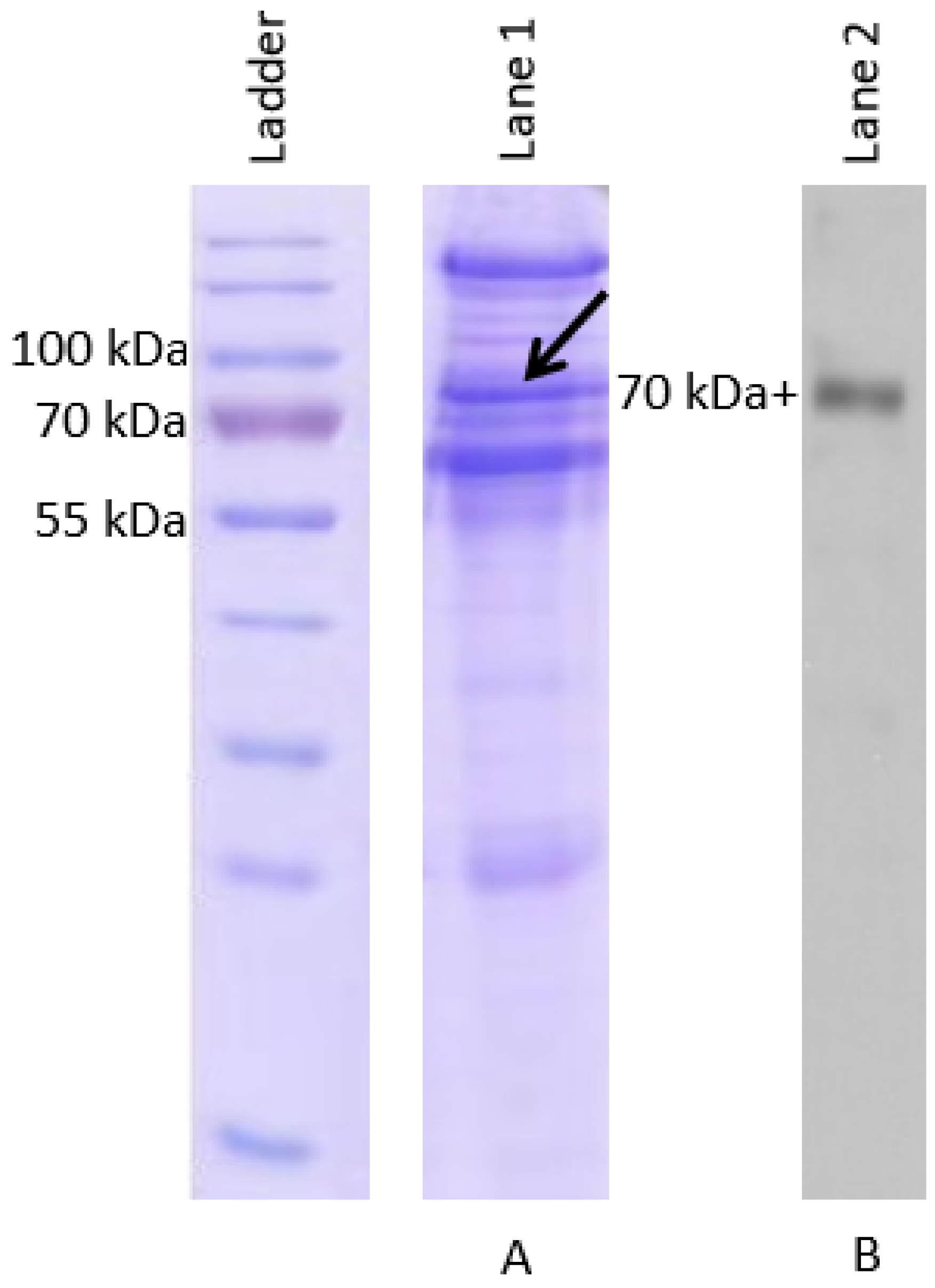 Vaccines 08 00257 g001 Vaccines 08 00257 g001