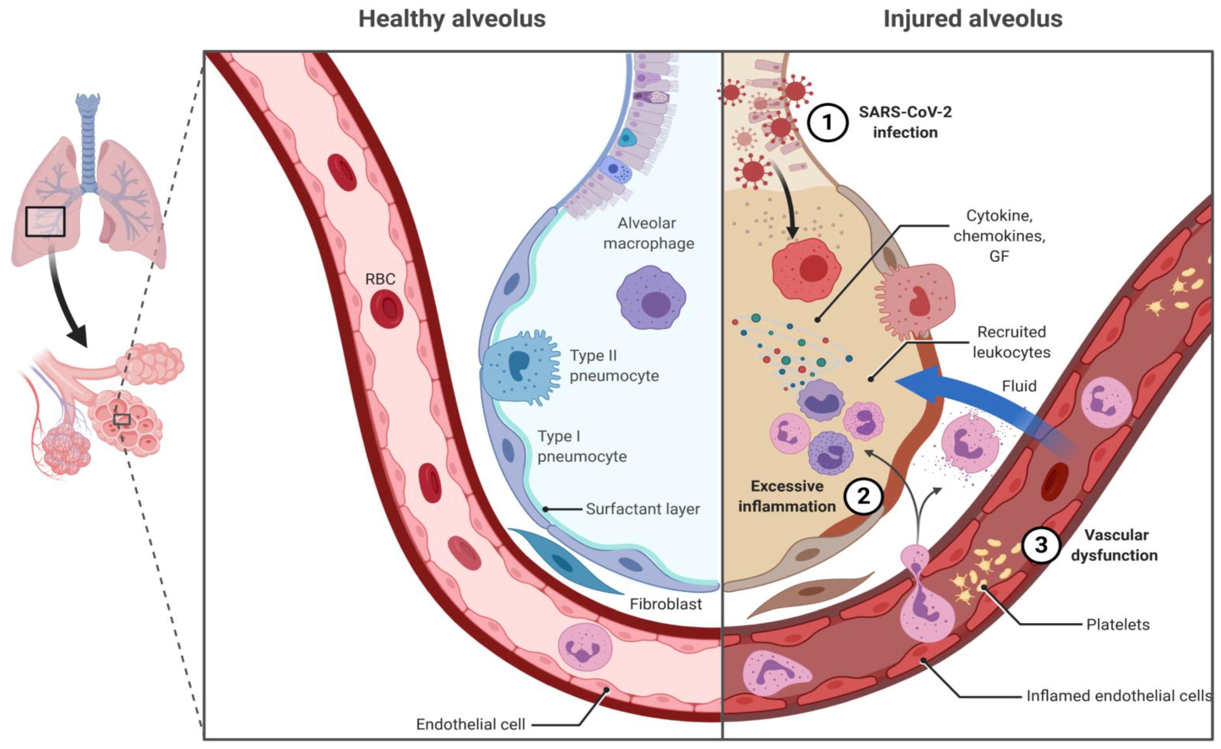 Vaccines 09 00151 g001