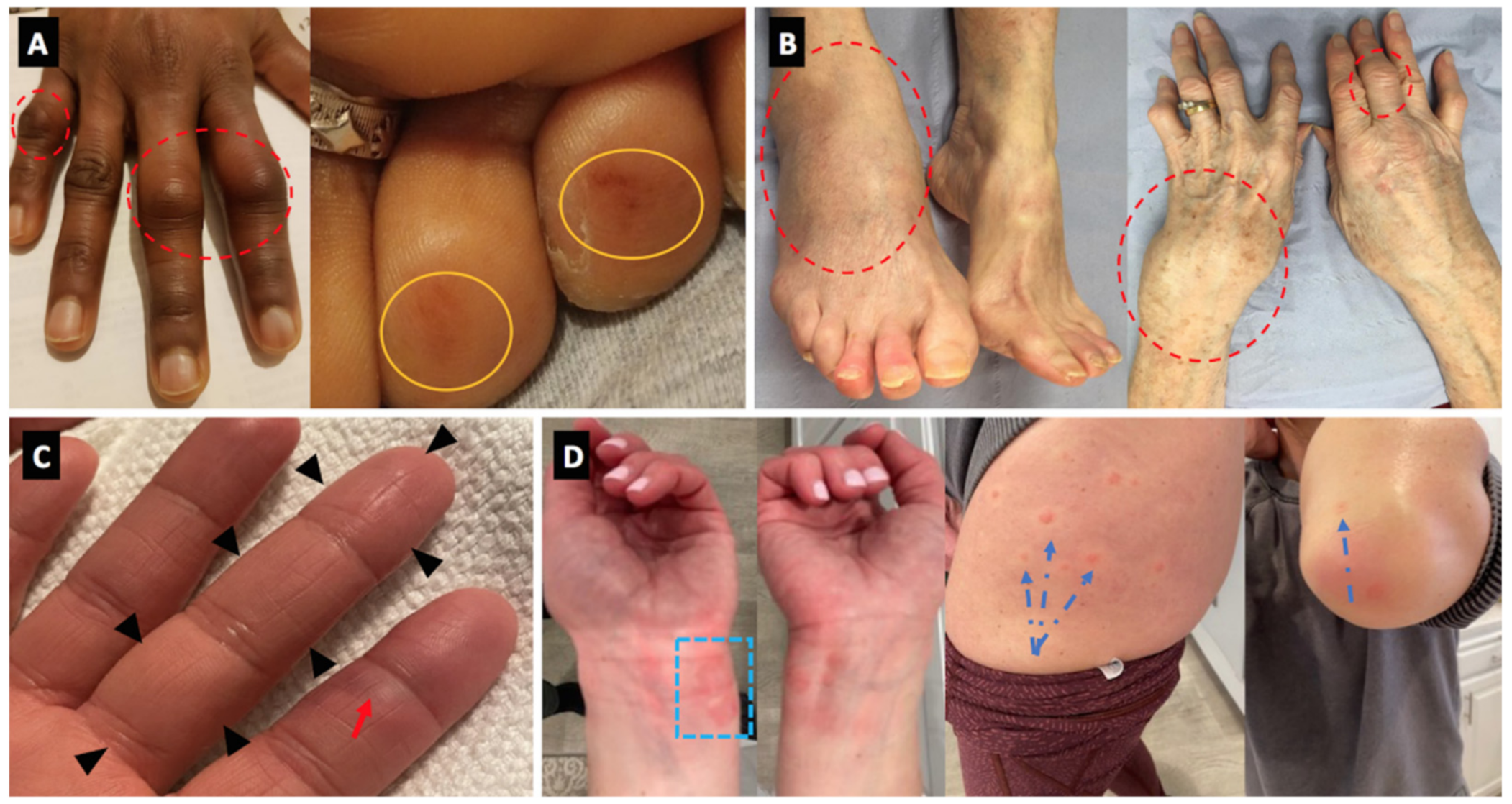 Vaccines 09 00435 g002 Vaccines 09 00435 g002