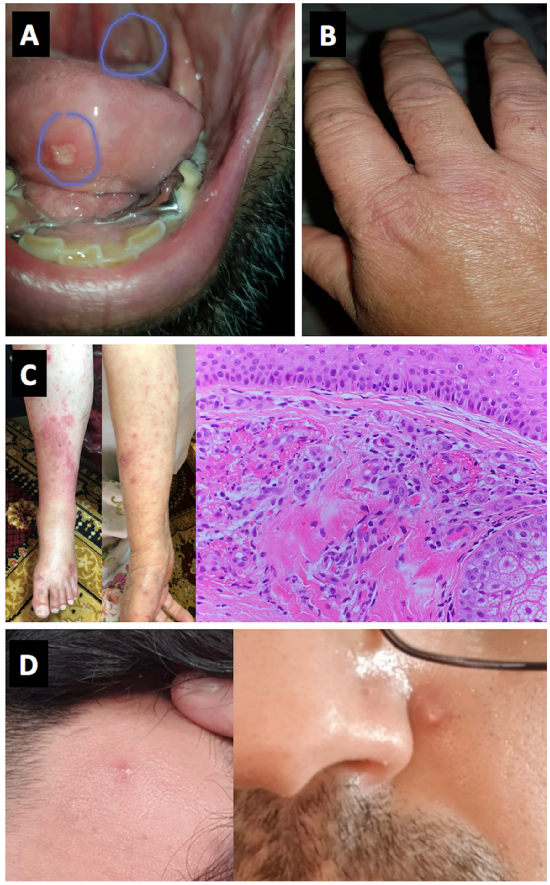 Vaccines 09 00435 g003 Vaccines 09 00435 g003