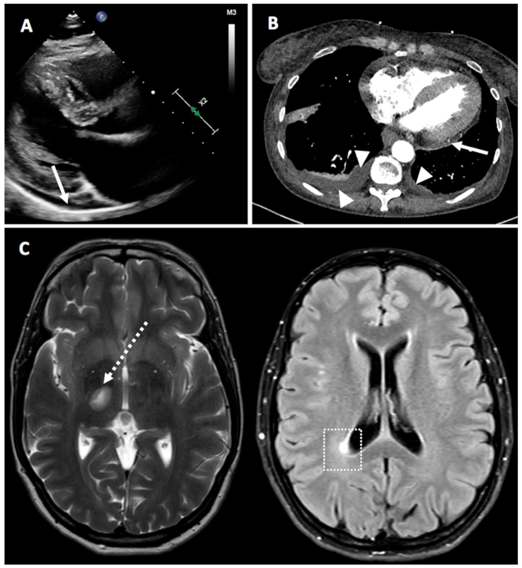Vaccines 09 00435 g004 Vaccines 09 00435 g004