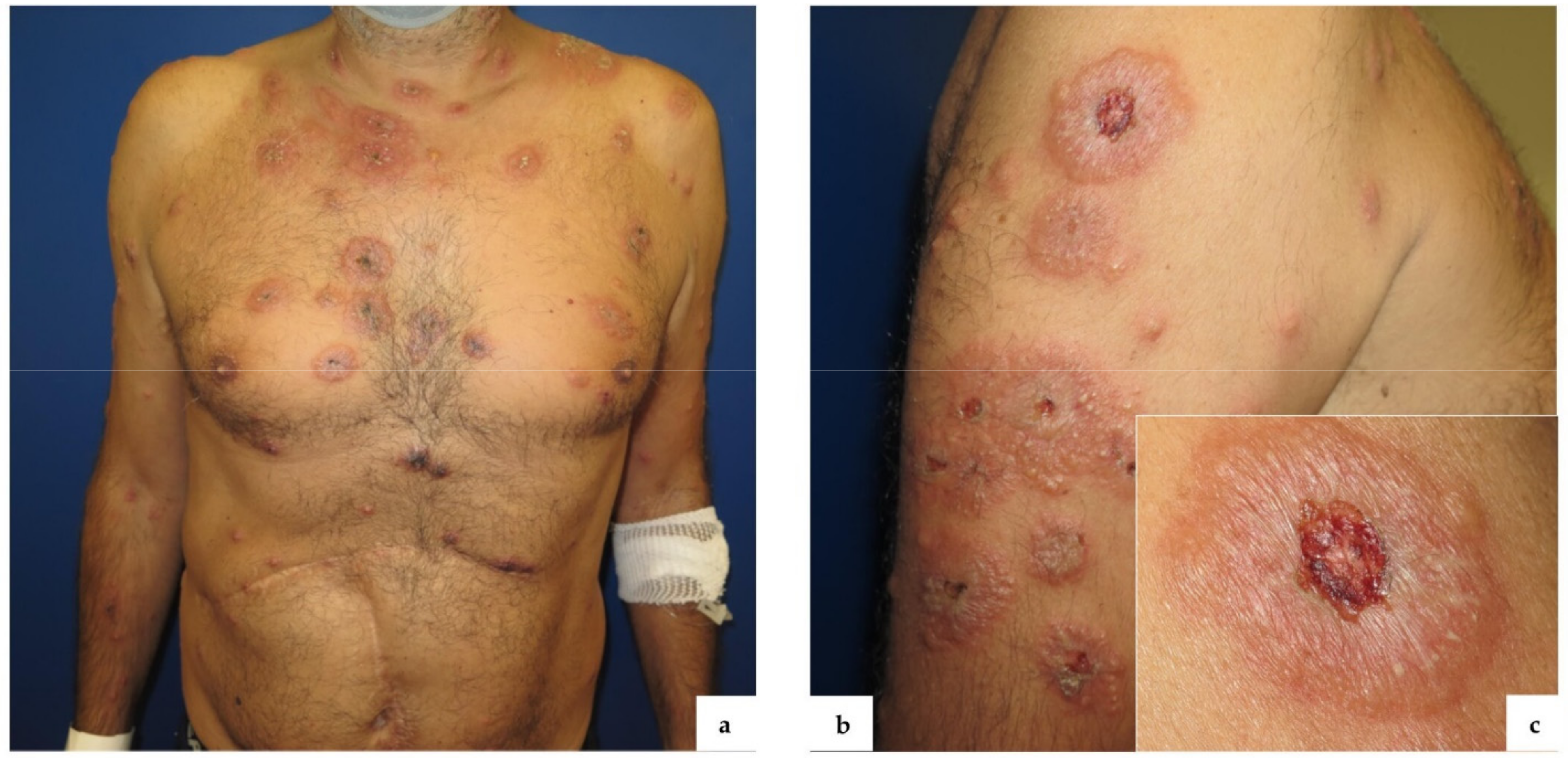 Vaccines 09 01212 g001