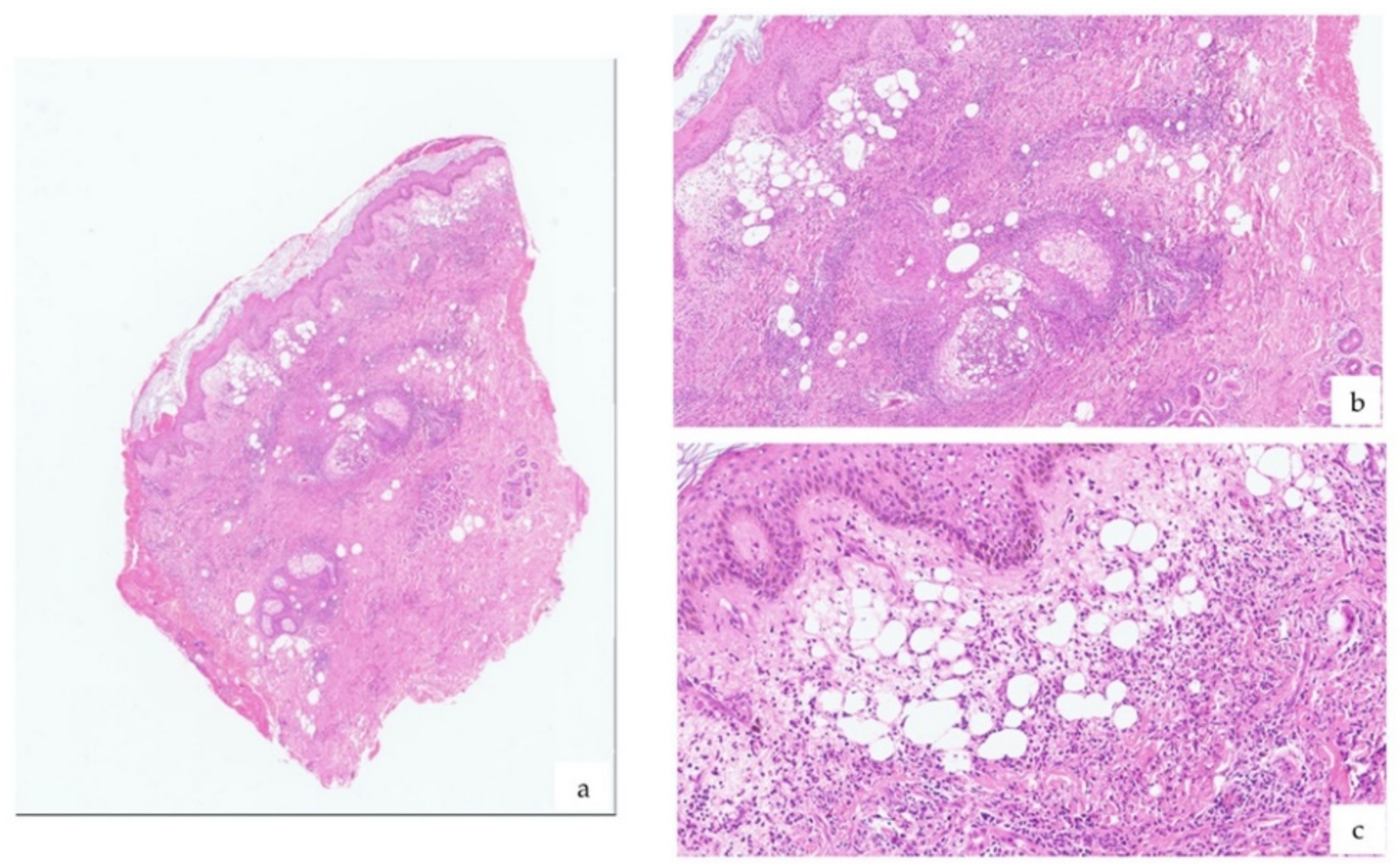 Vaccines 09 01212 g002