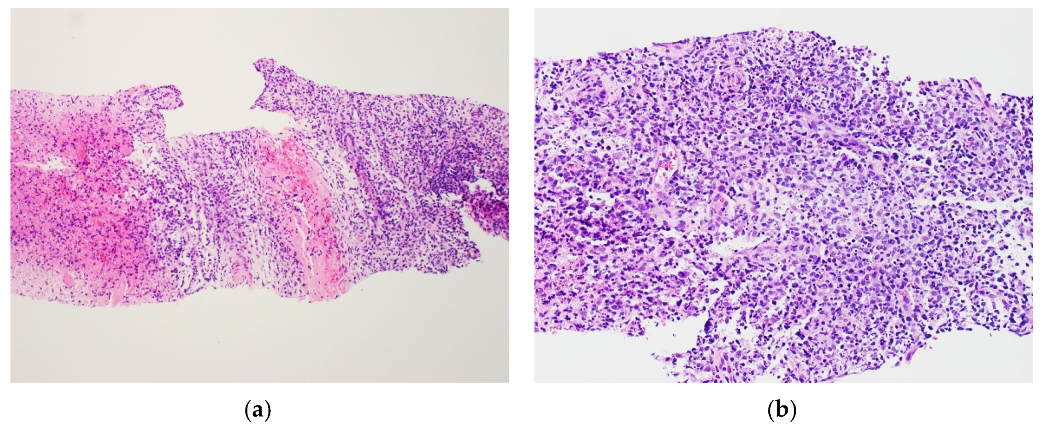 Vaccines 09 01251 g002