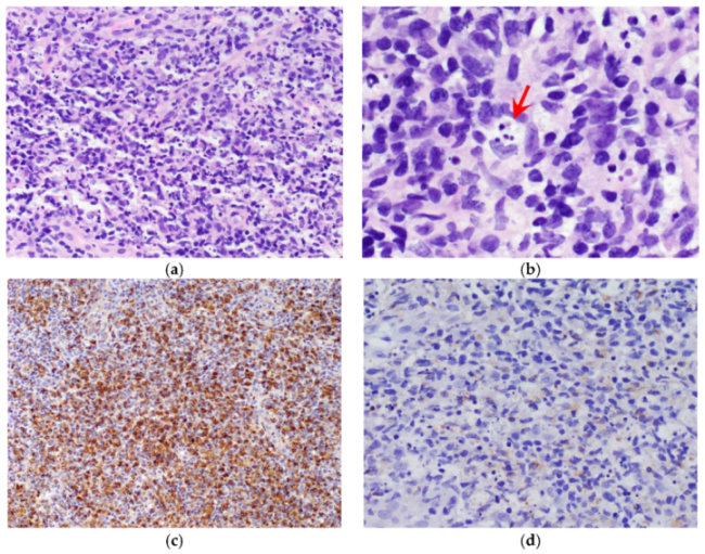 Vaccines 09 01251 g004