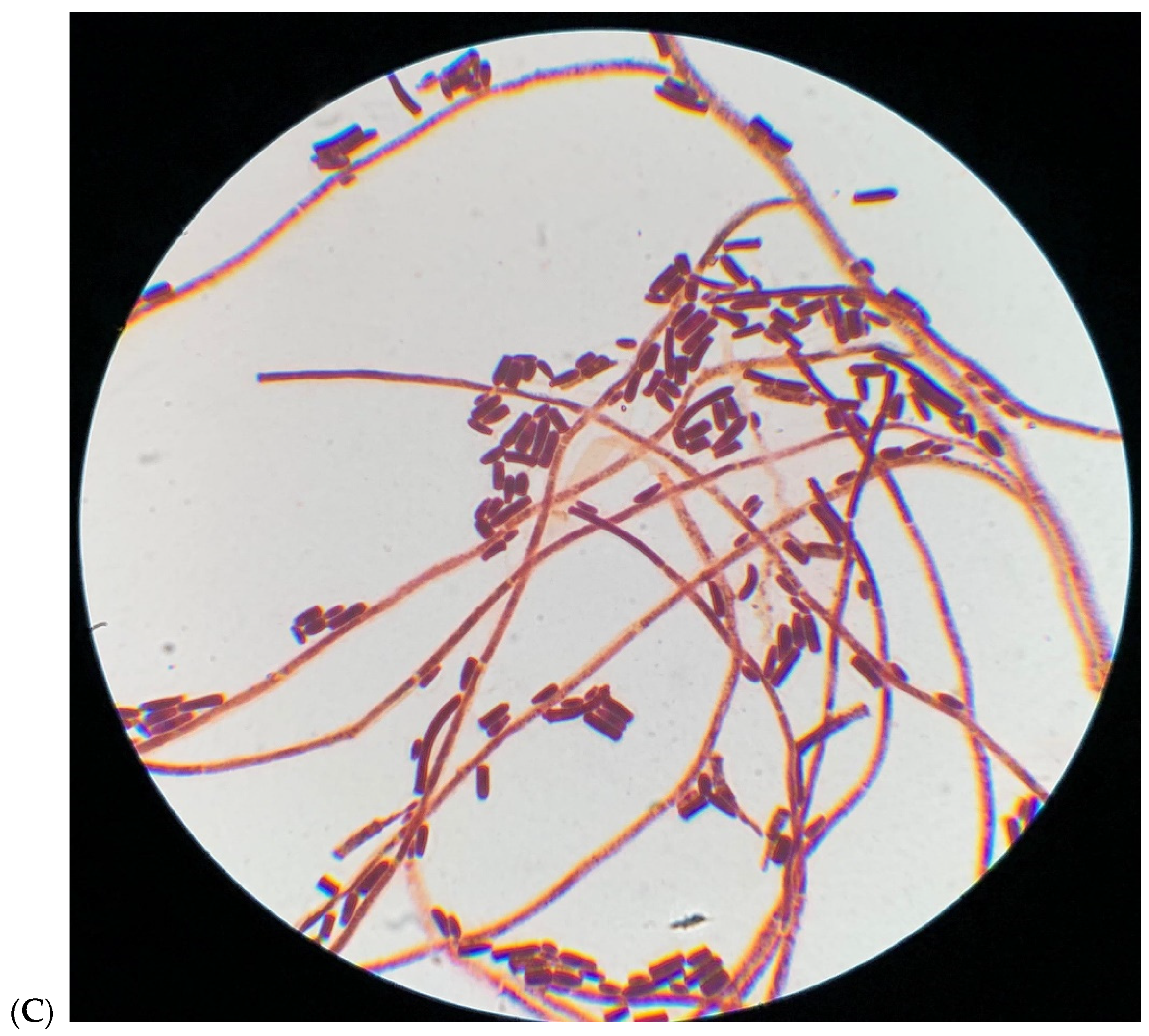 Vaccines 09 01289 g001b Vaccines 09 01289 g001b