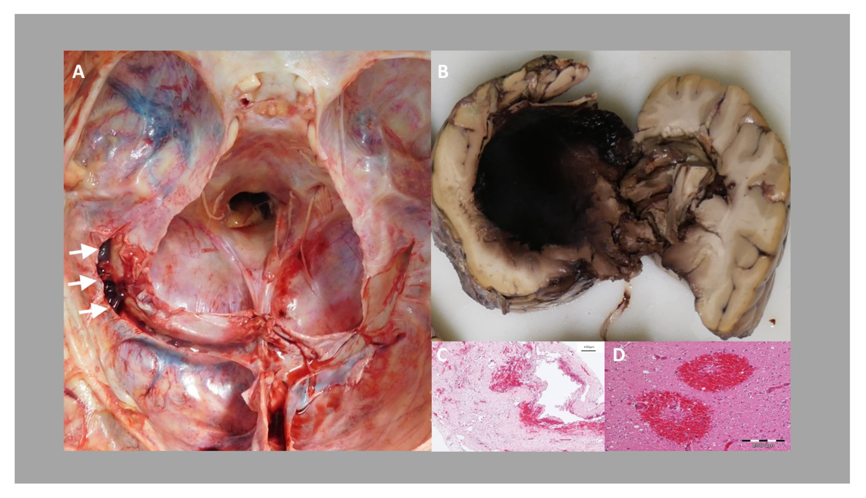 Vaccines 09 01344 g005