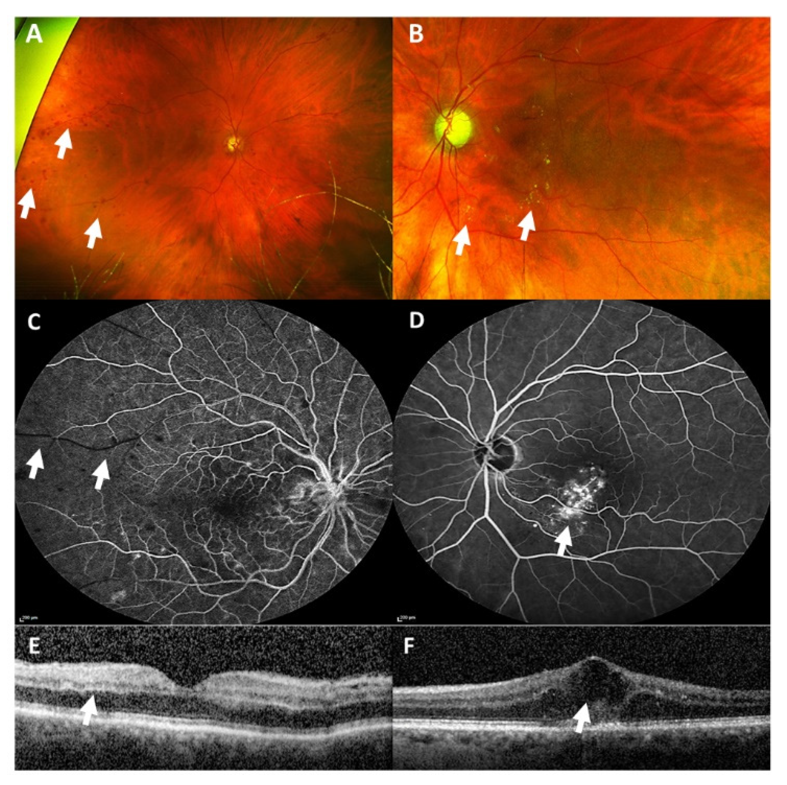 Vaccines 09 01349 g002