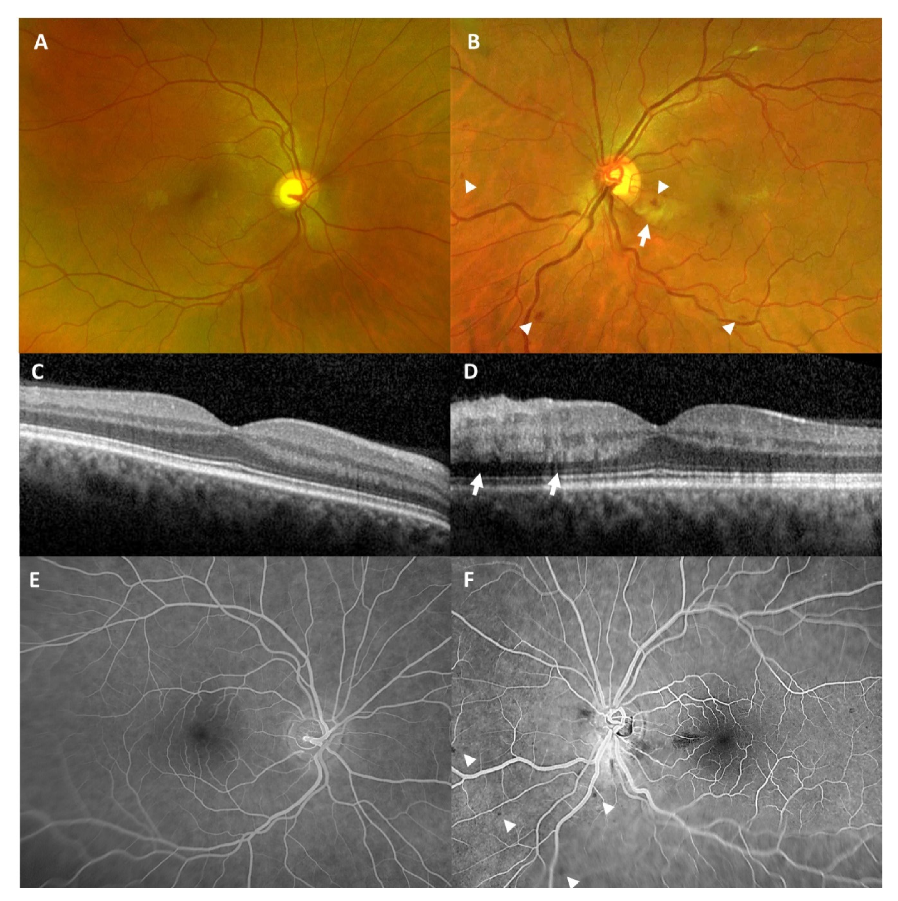 Vaccines 09 01349 g003