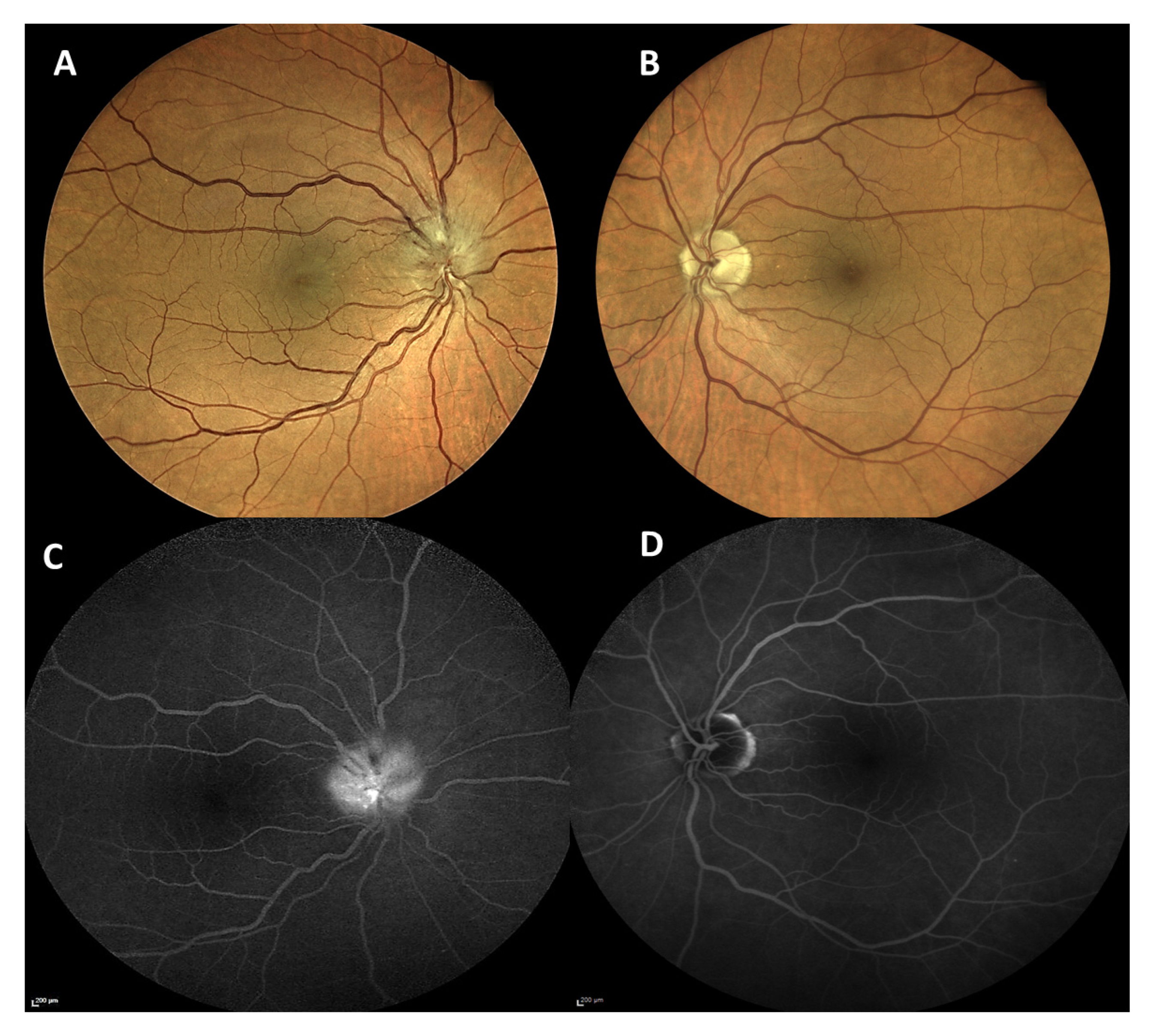 Vaccines 09 01349 g004