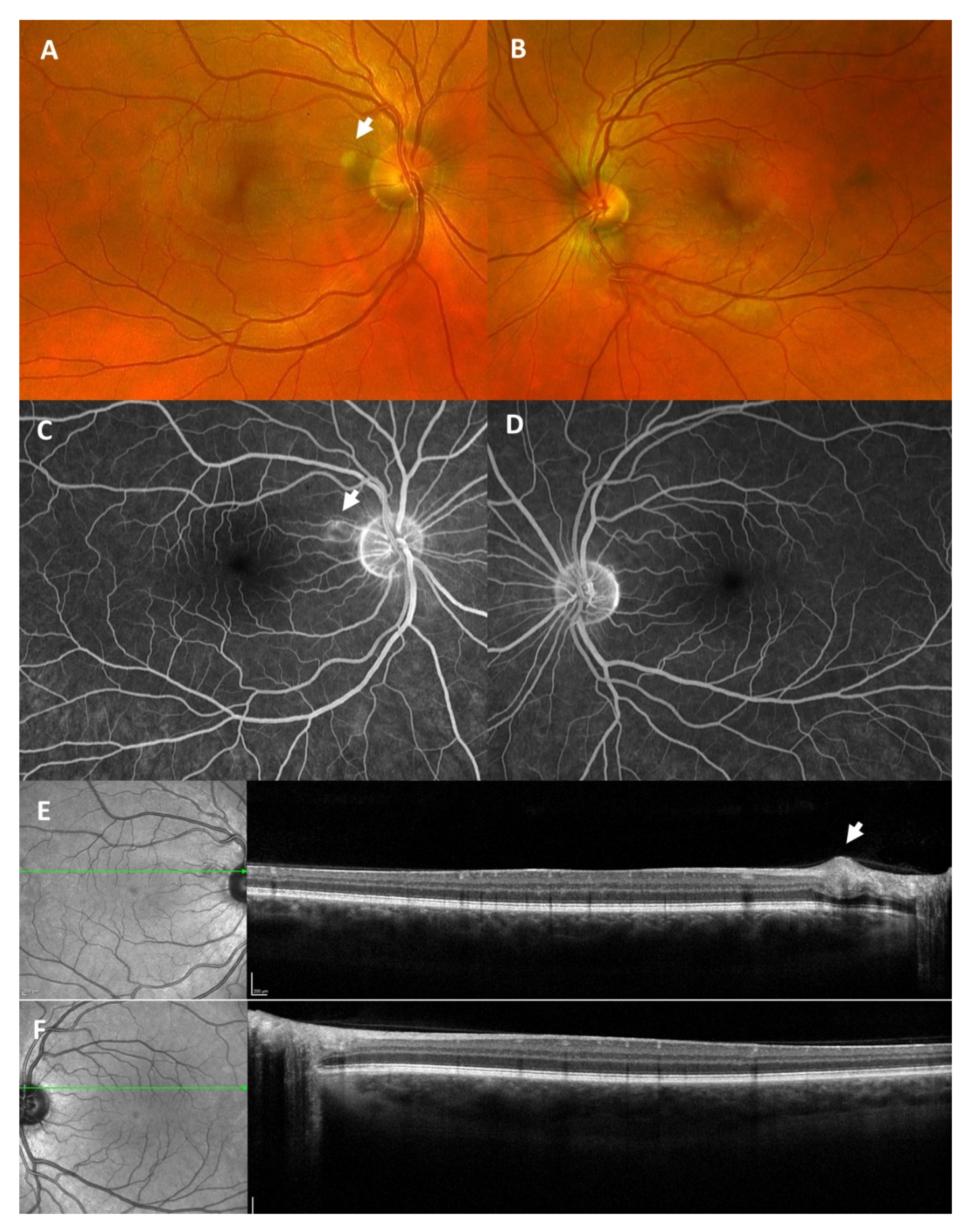Vaccines 09 01349 g005