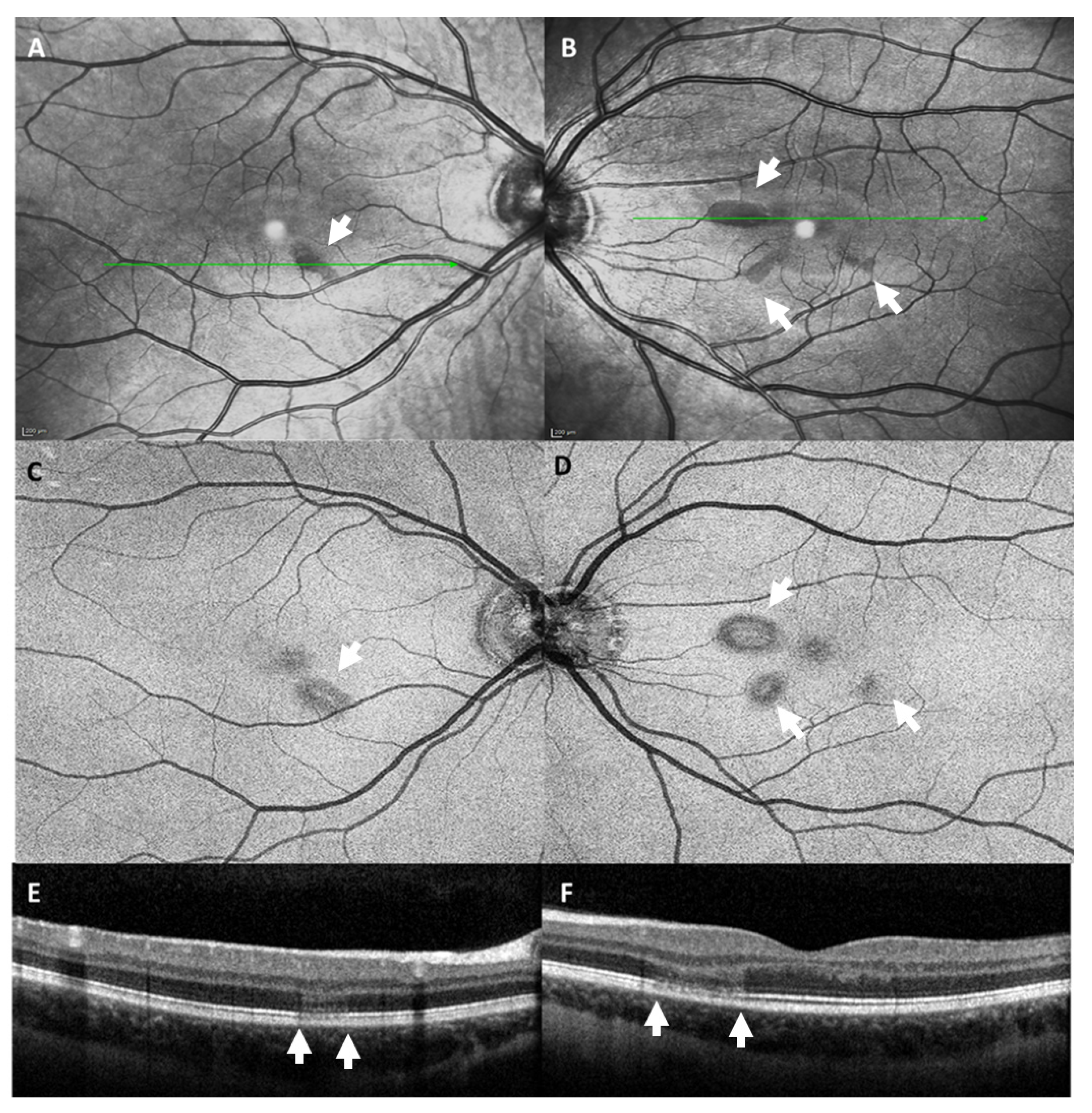 Vaccines 09 01349 g006