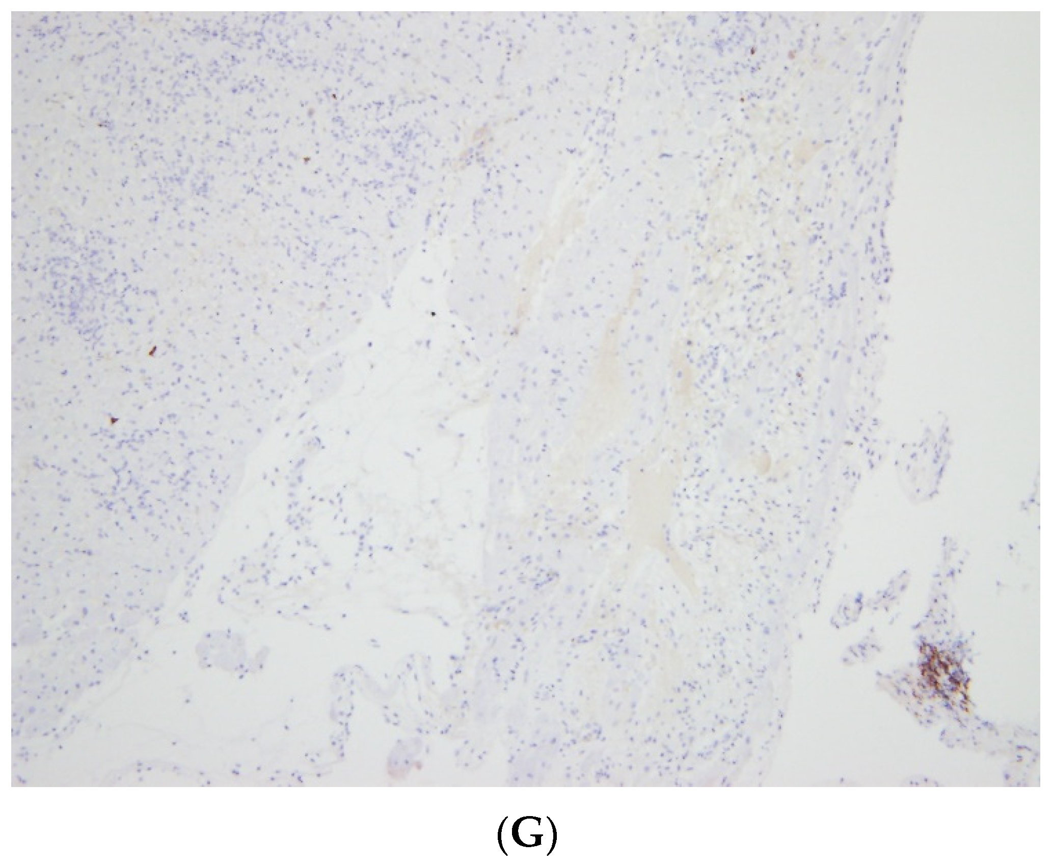 Vaccines 10 00304 g002b