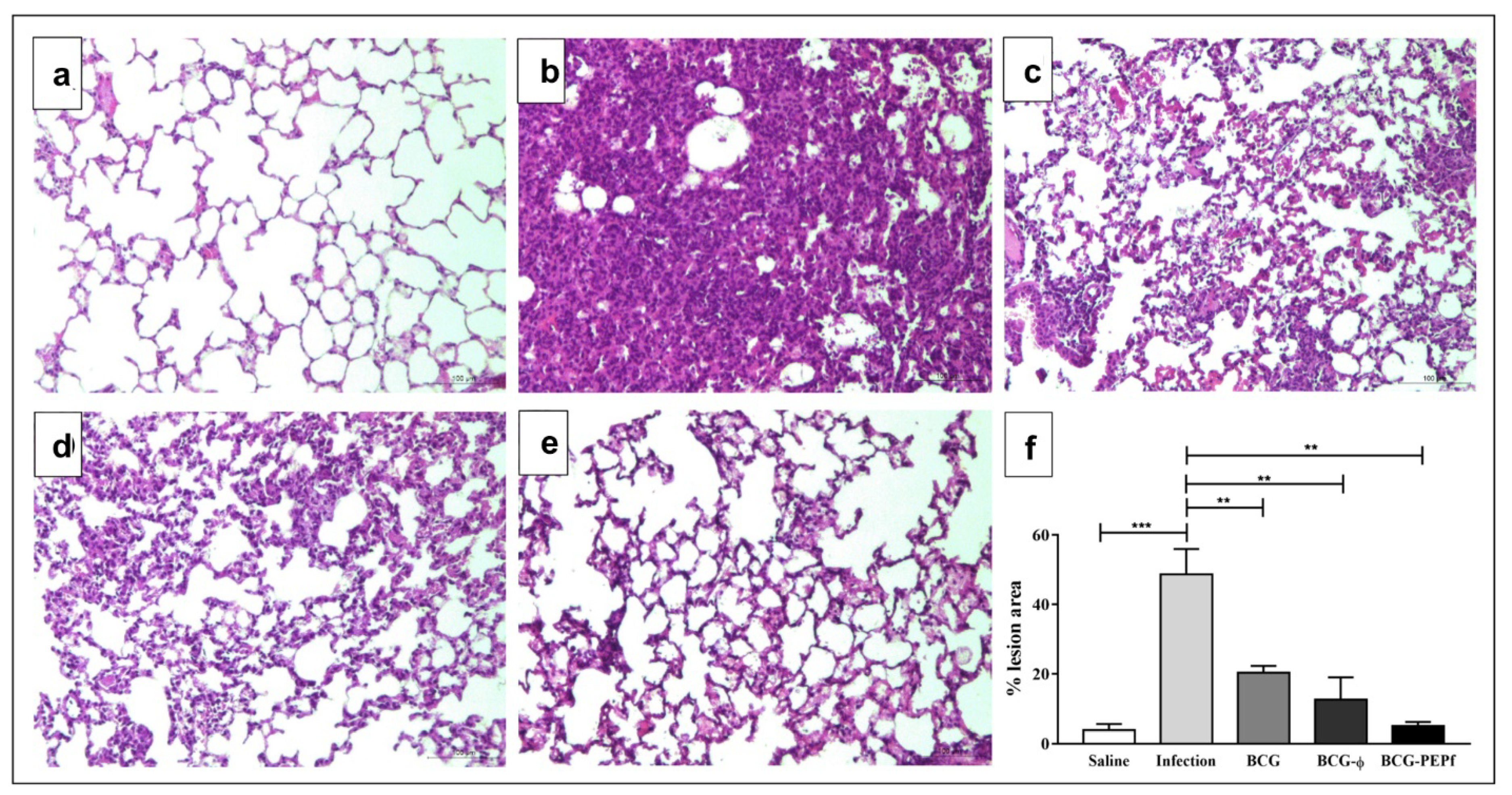 Vaccines 10 00306 g004