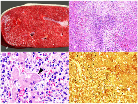 Vaccines 10 00318 g004 550