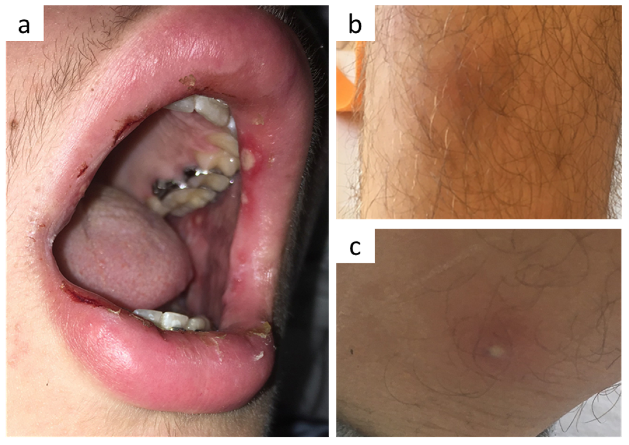 Vaccines 10 00325 g001