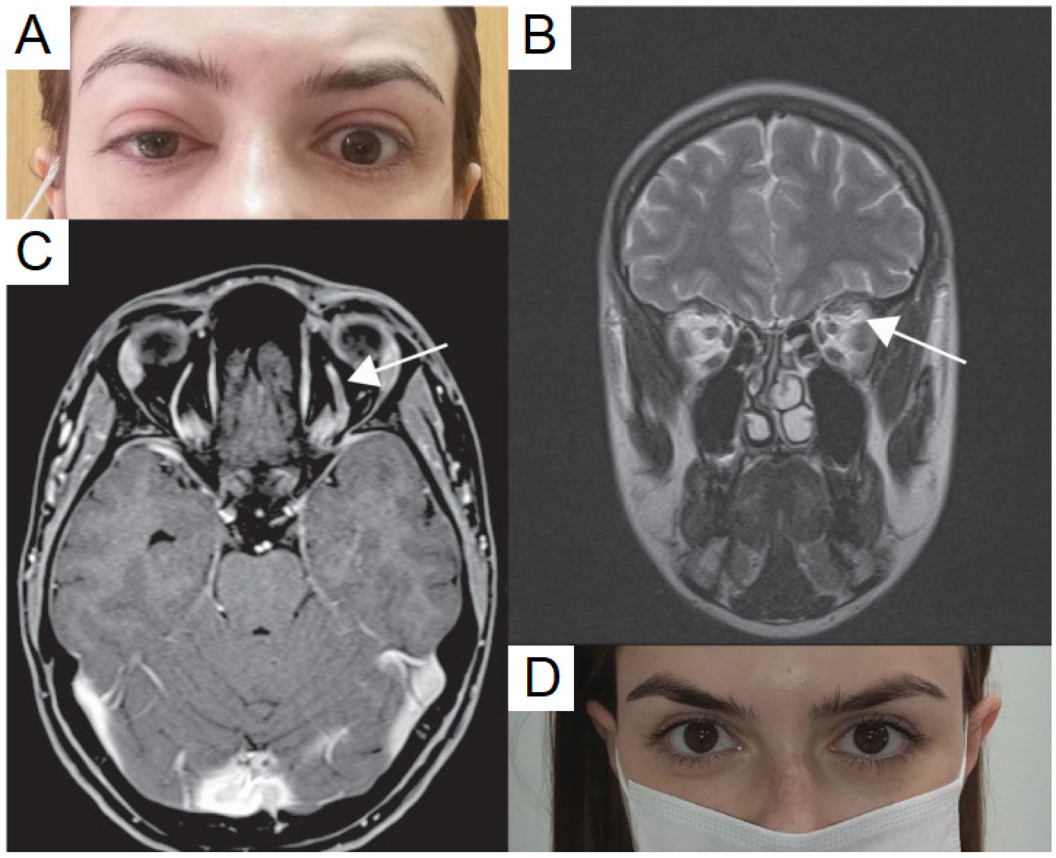 Vaccines 10 00342 g001 Vaccines 10 00342 g001