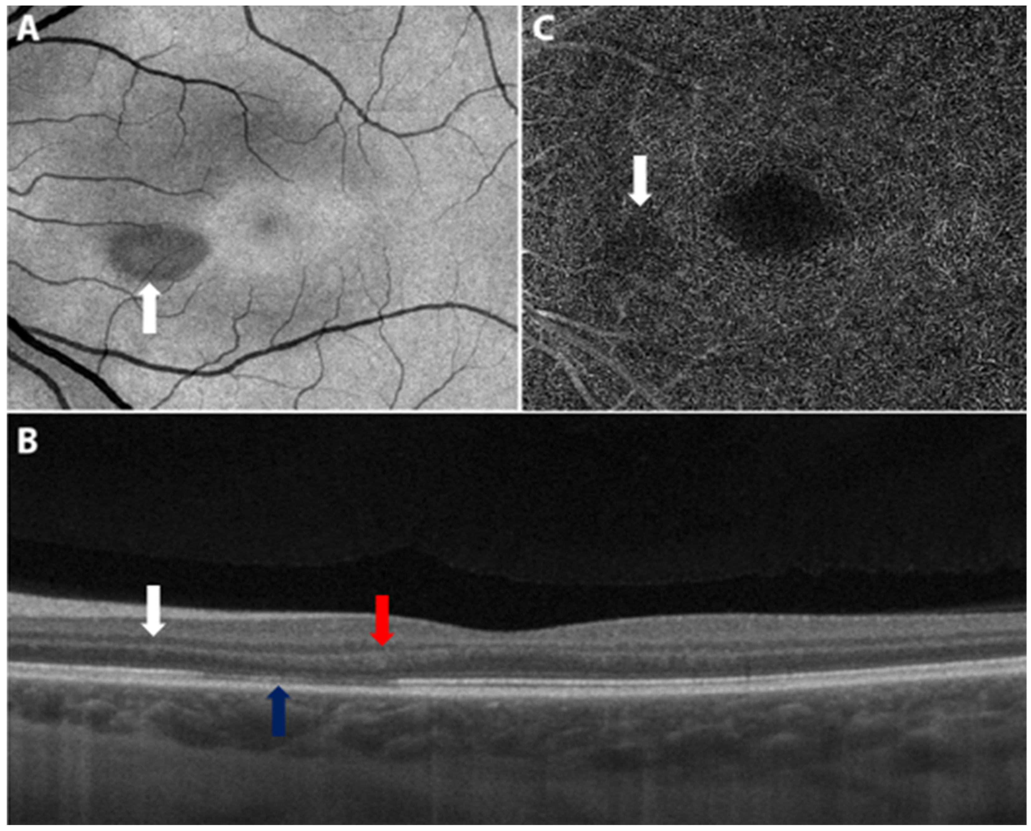 Vaccines 10 00342 g004 Vaccines 10 00342 g004
