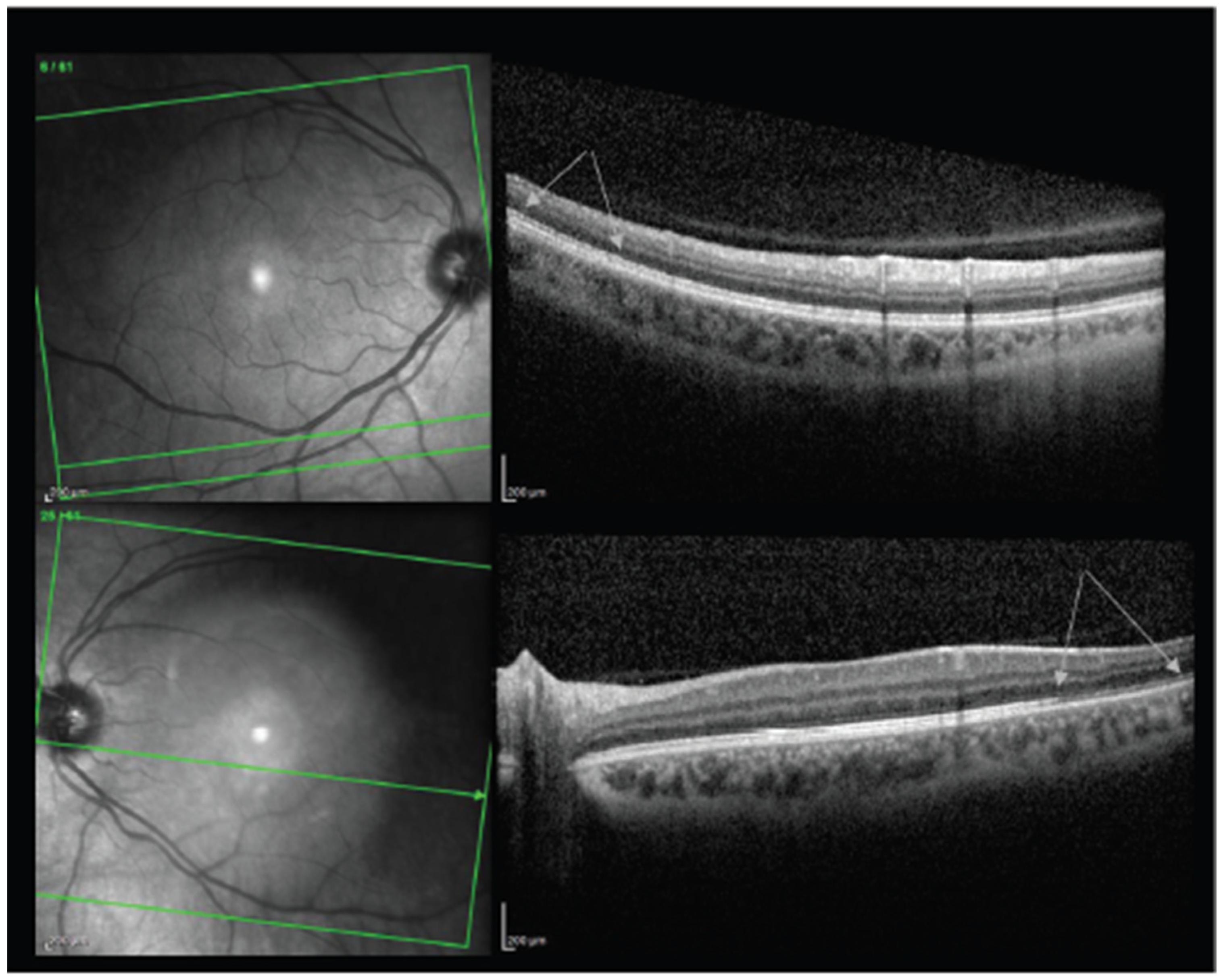 Vaccines 10 00342 g005 Vaccines 10 00342 g005