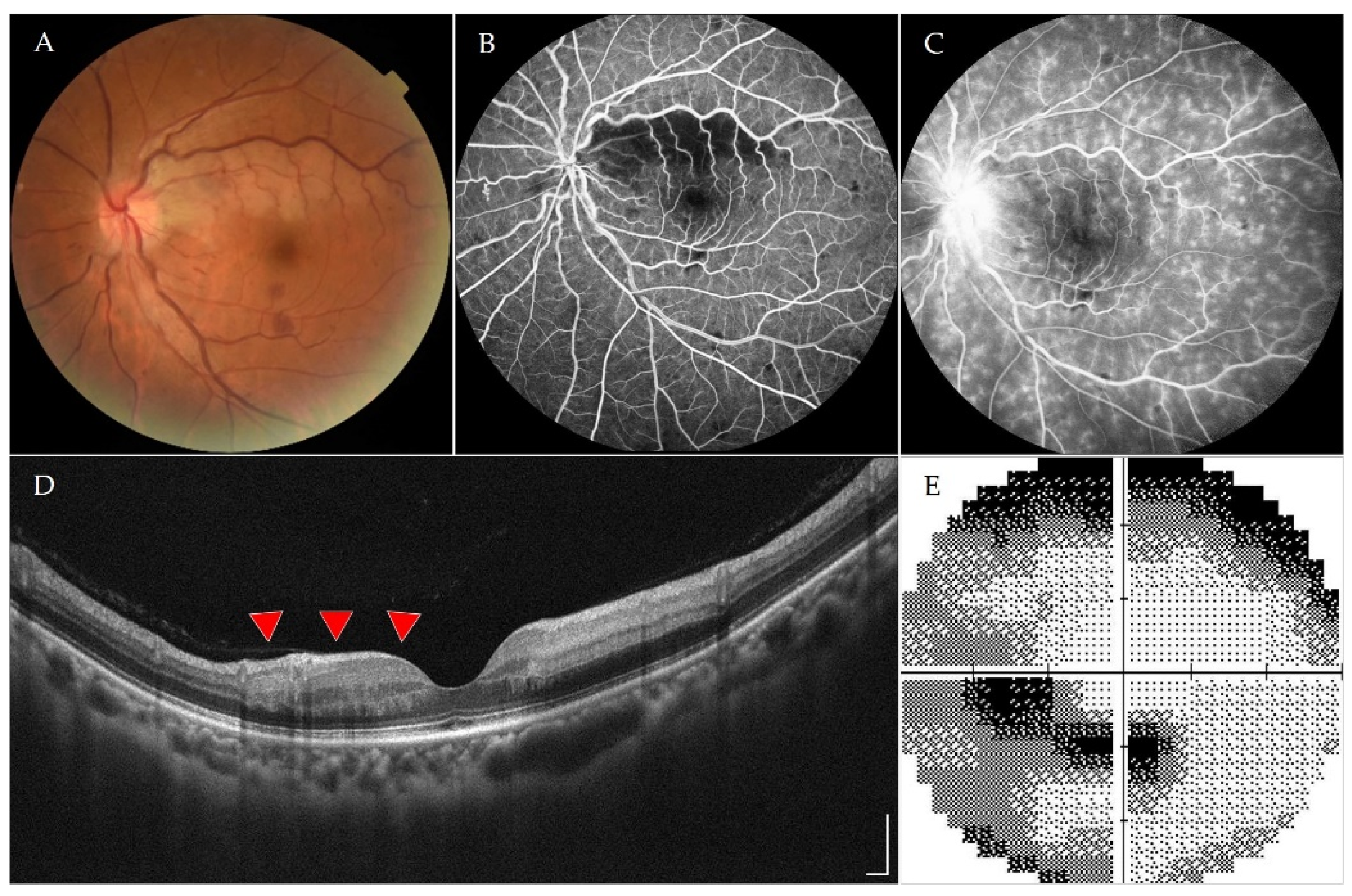 Vaccines 10 00363 g001