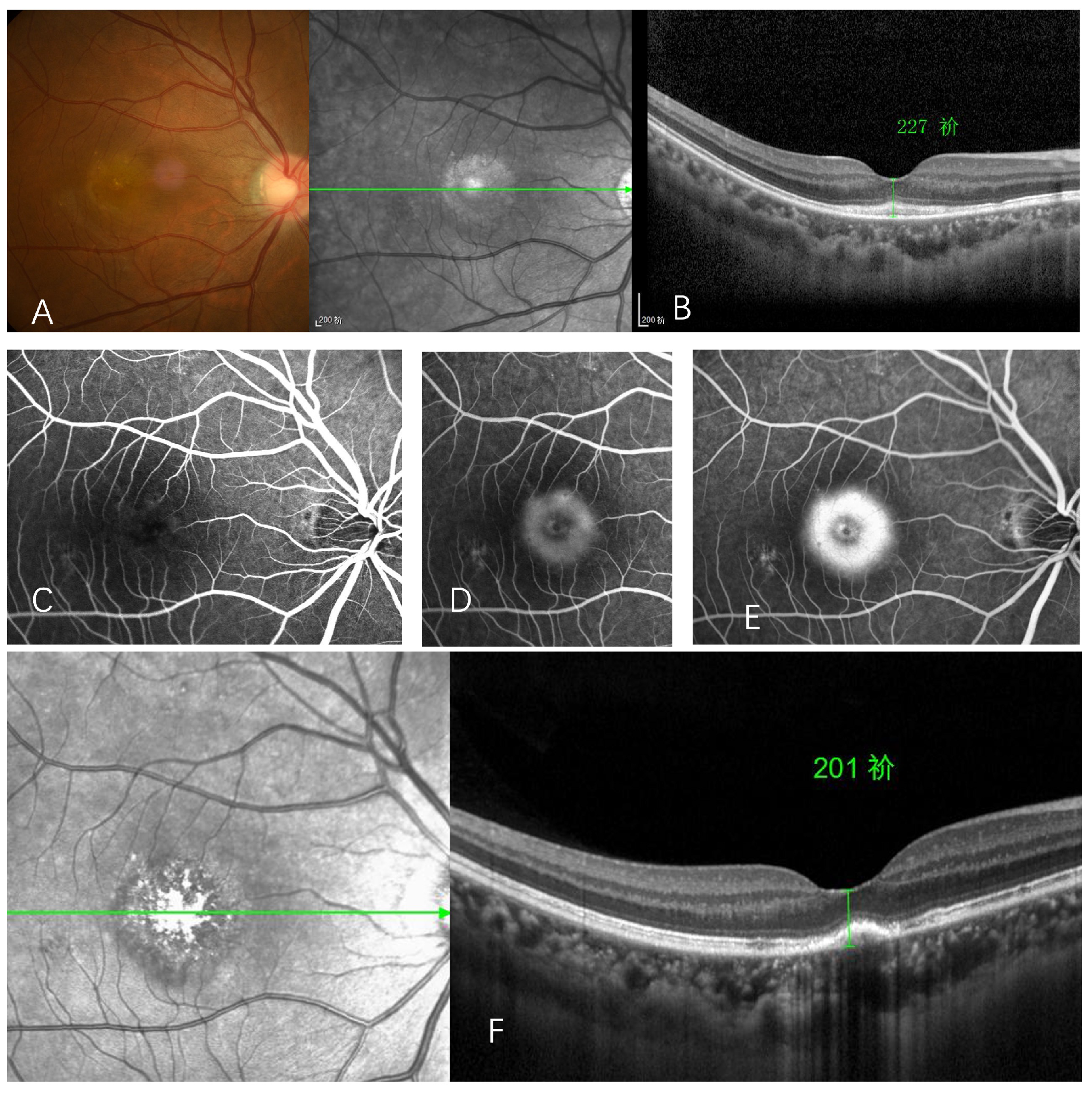 Vaccines 10 00482 g003