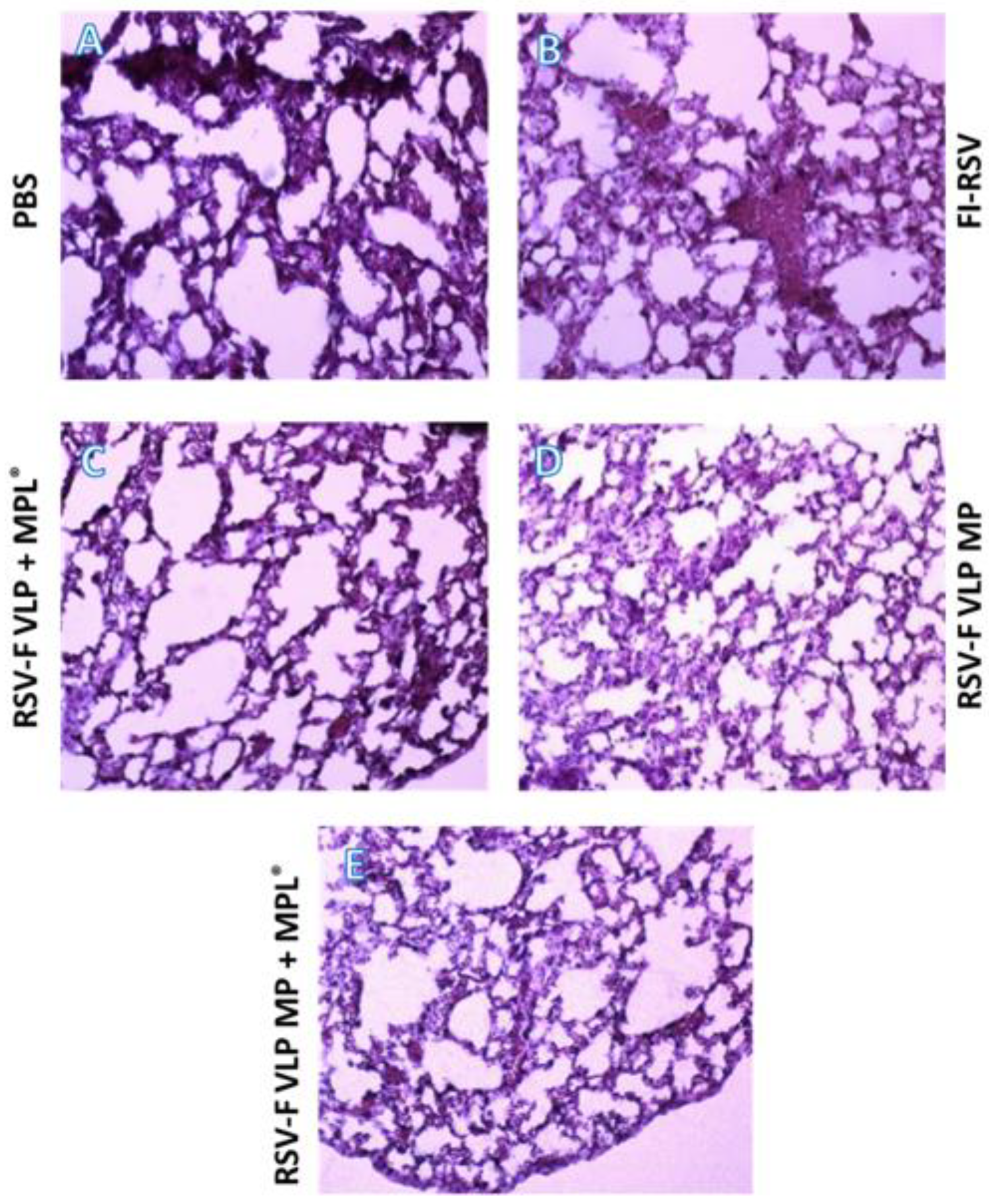 Vaccines 10 00584 g006
