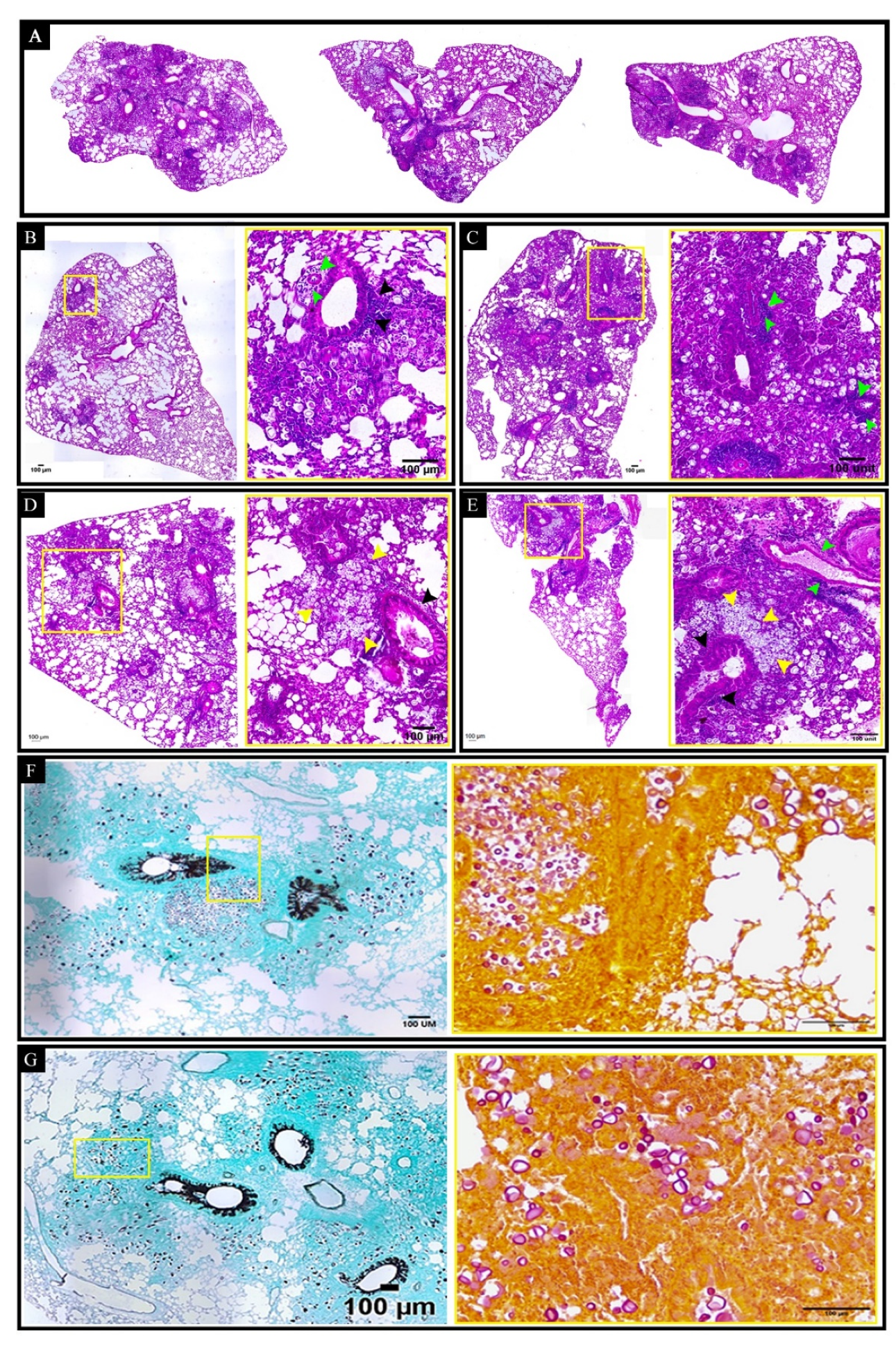 Vaccines 10 00620 g007