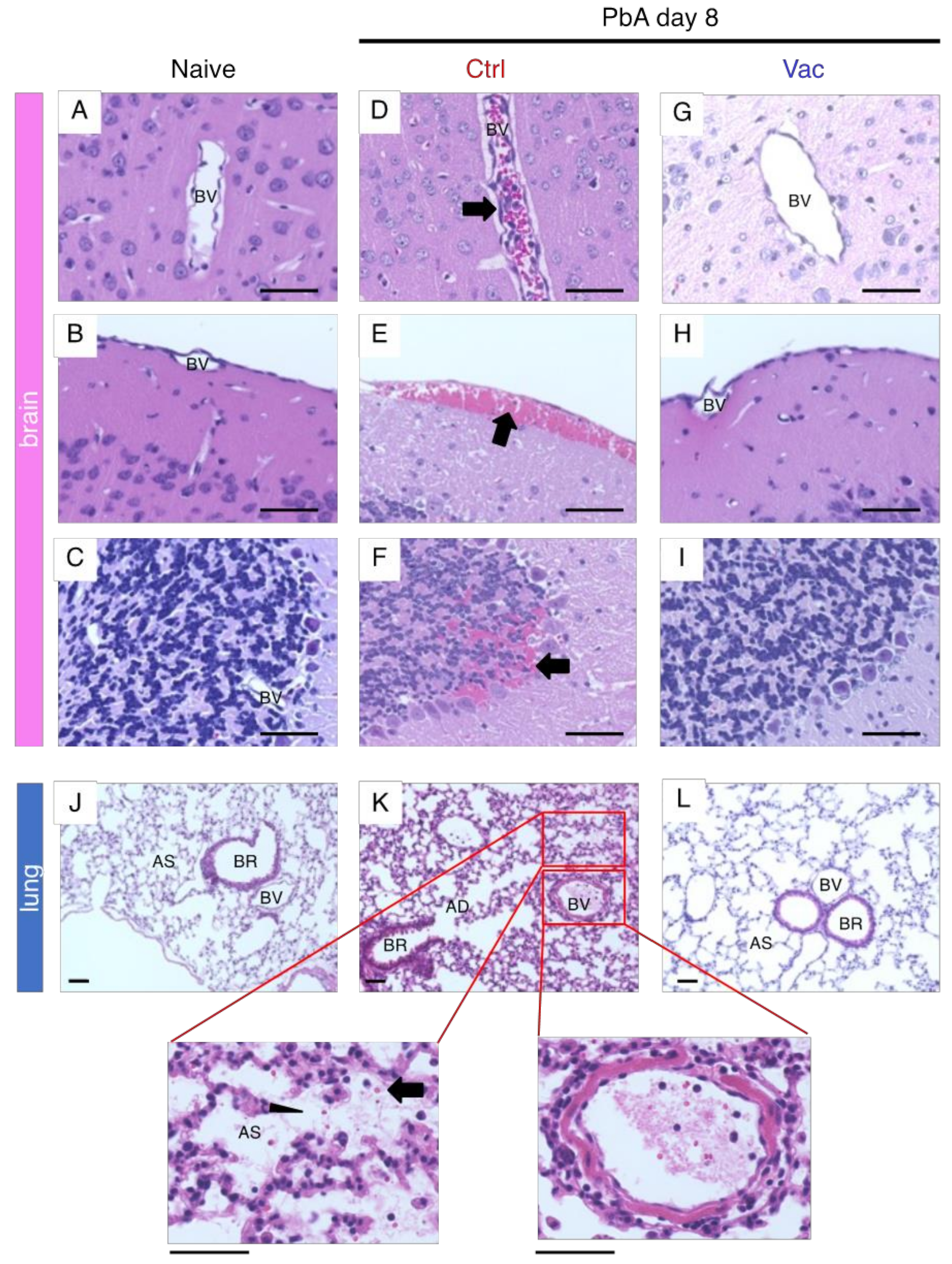 Vaccines 10 00762 g003