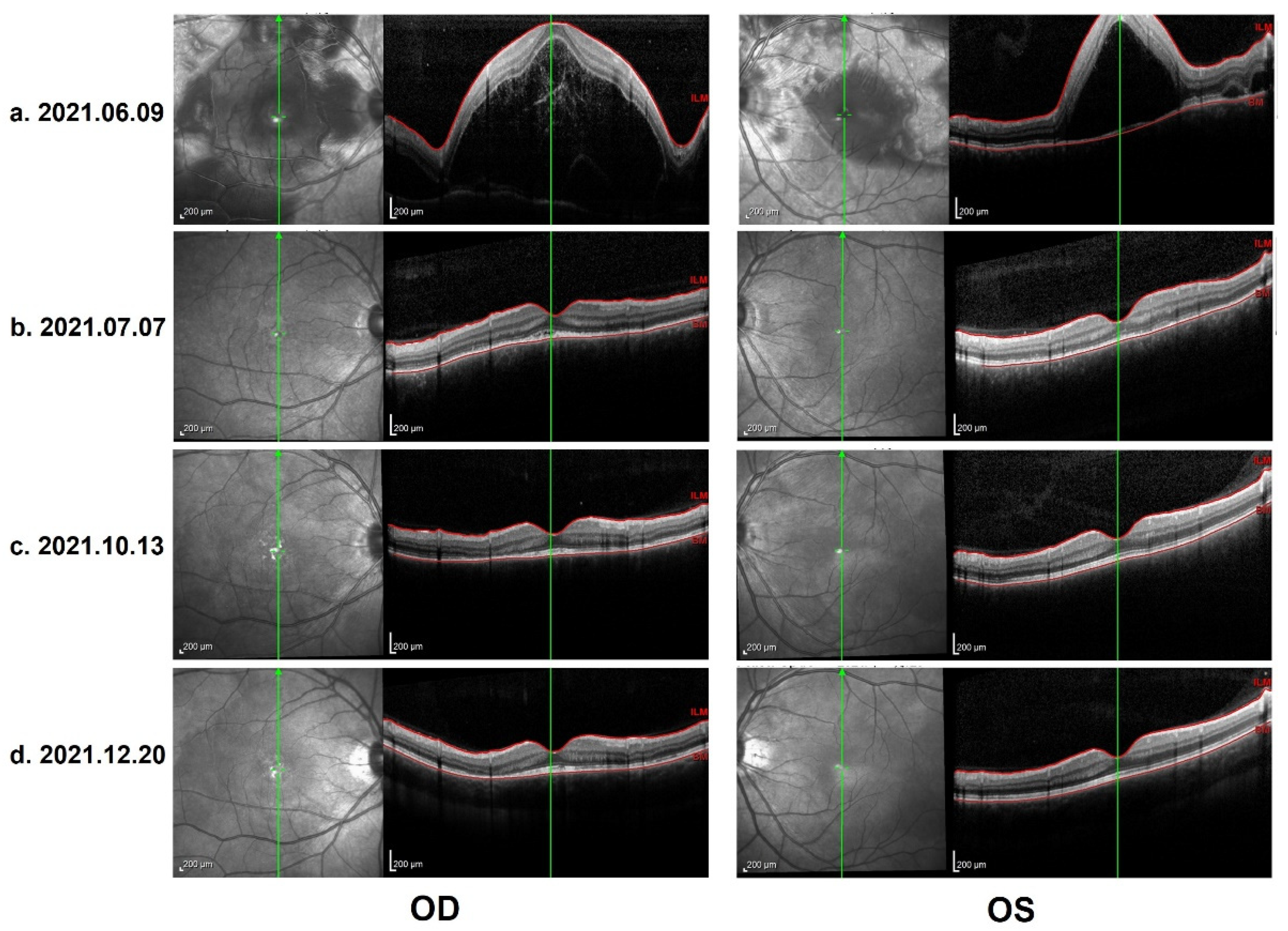 Vaccines 10 00783 g003