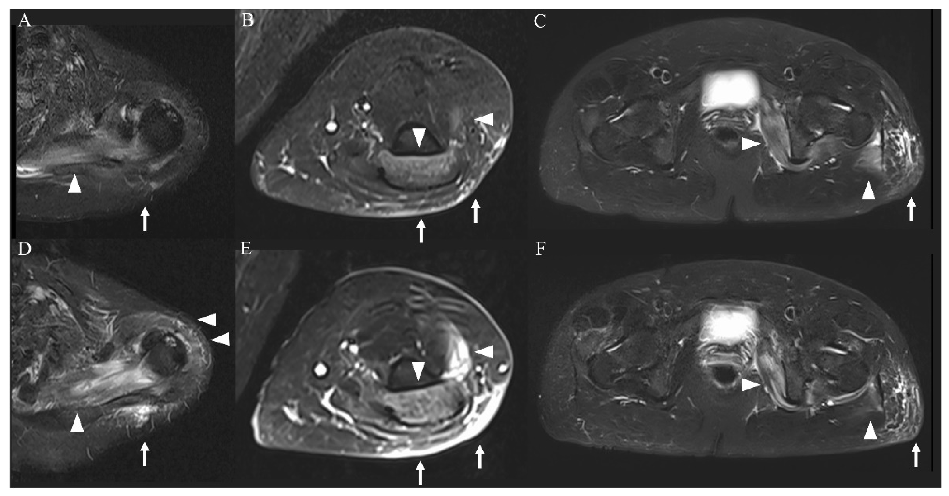 Vaccines 10 00935 g002