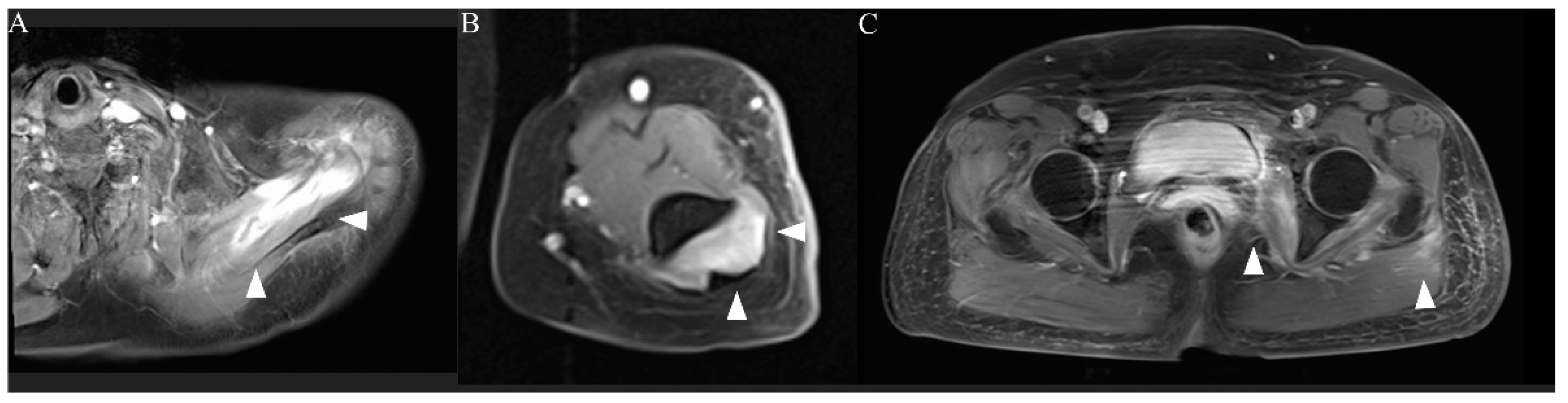 Vaccines 10 00935 g003