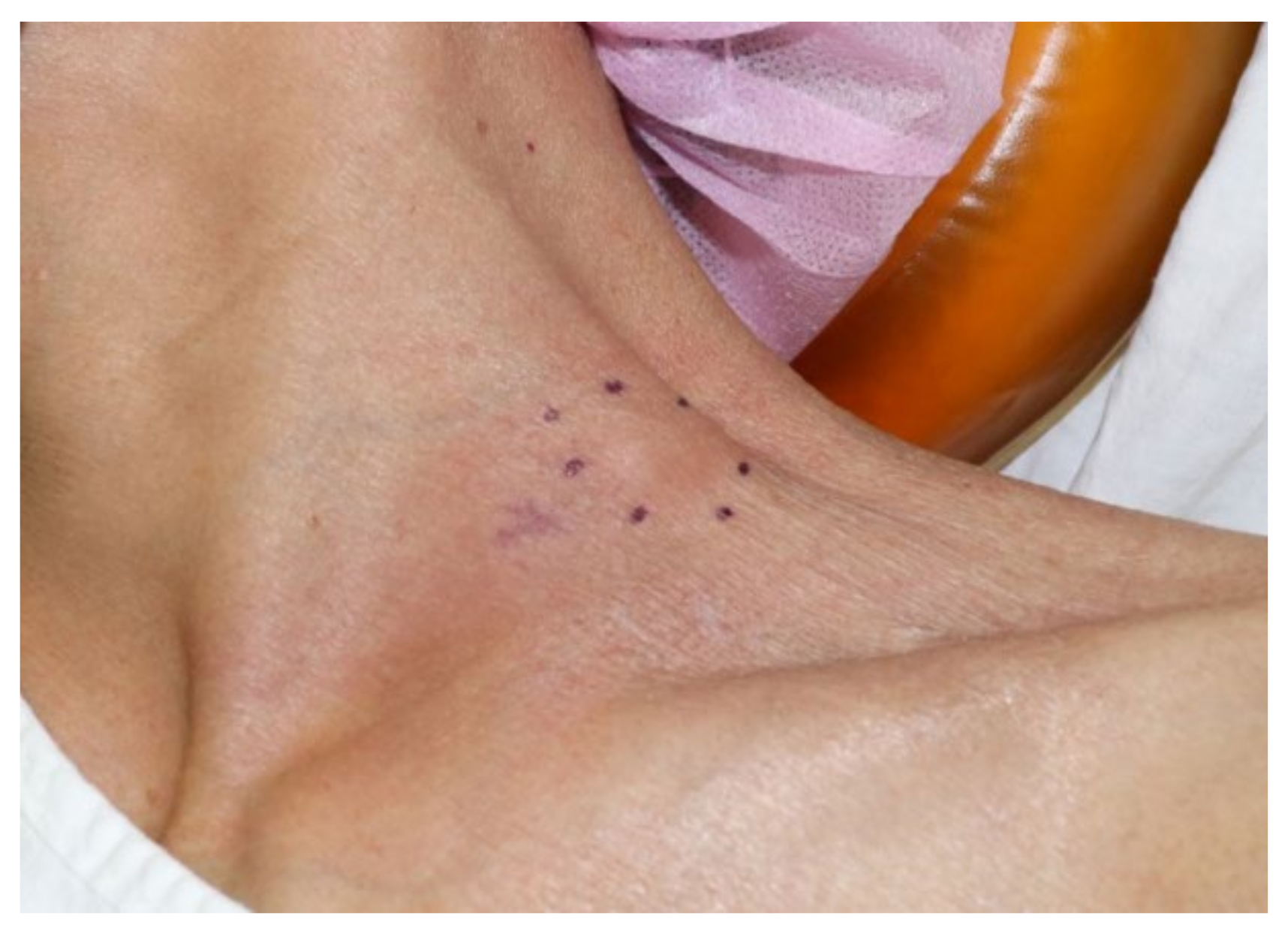 Vaccines 10 00964 g001