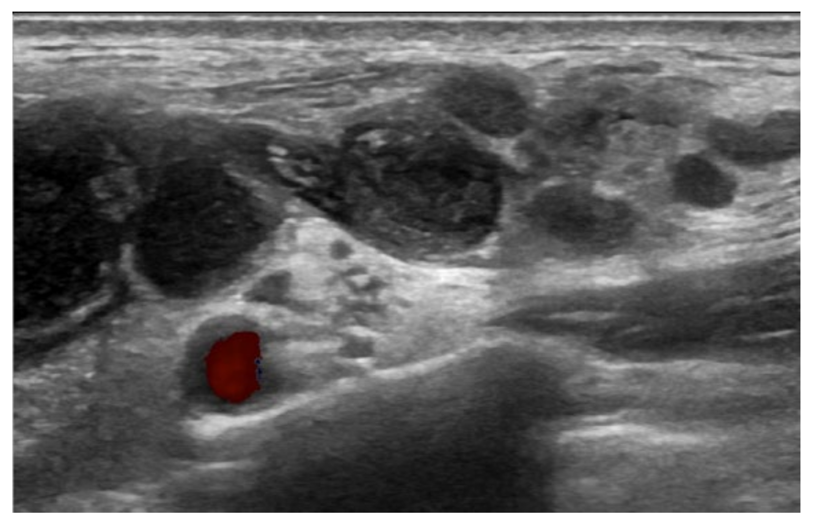 Vaccines 10 00964 g002