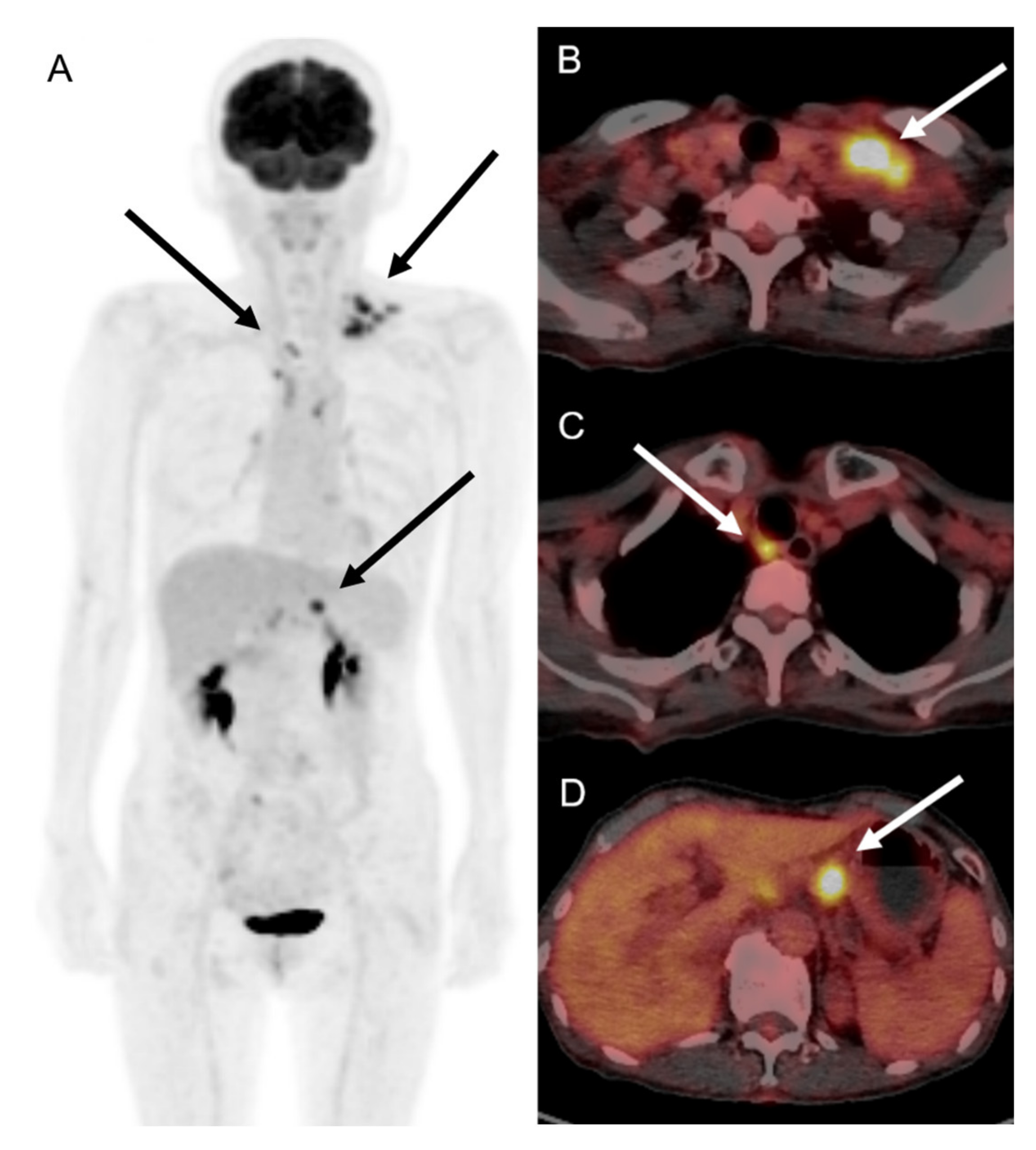 Vaccines 10 00964 g003