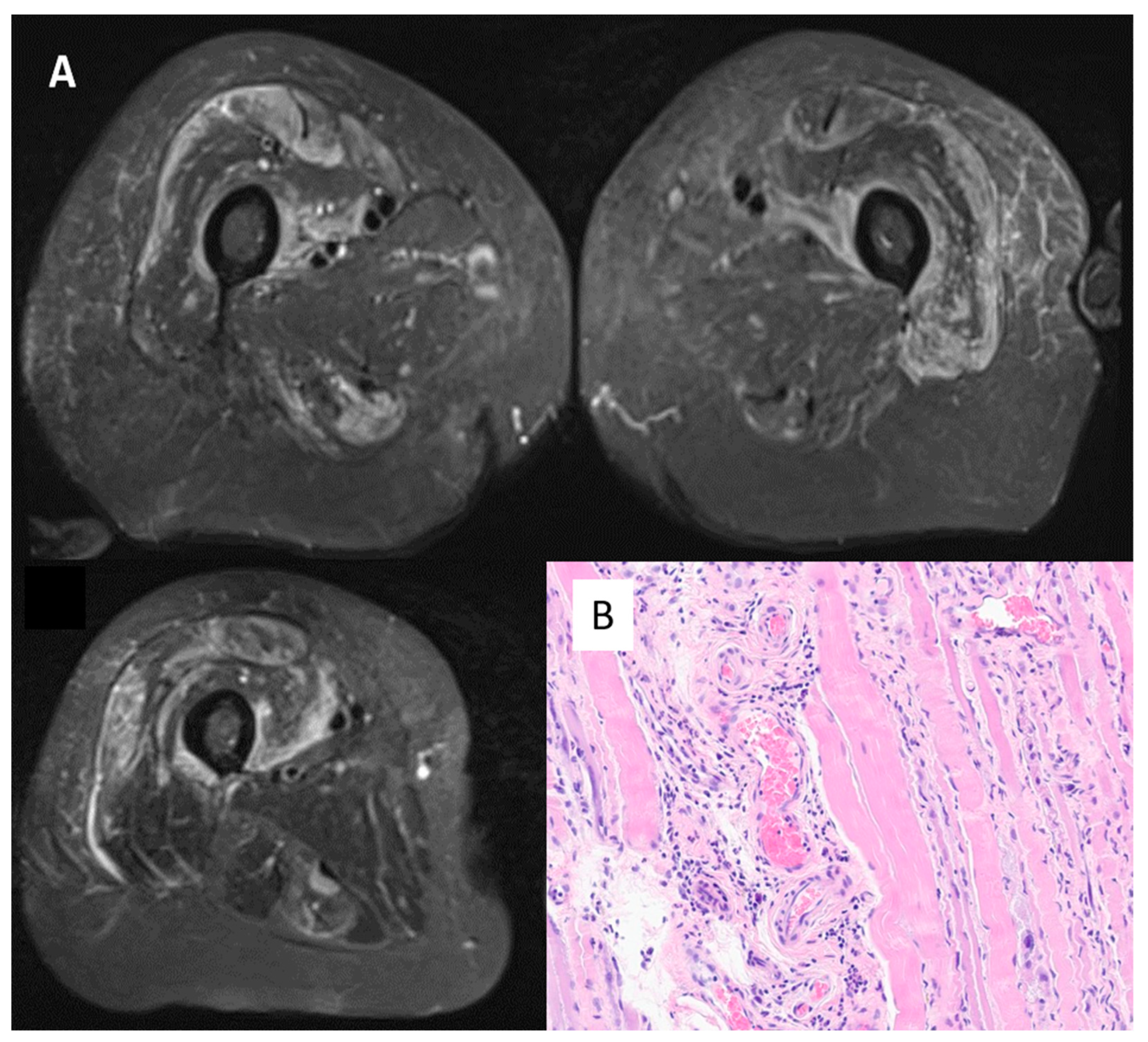 Vaccines 10 01184 g003