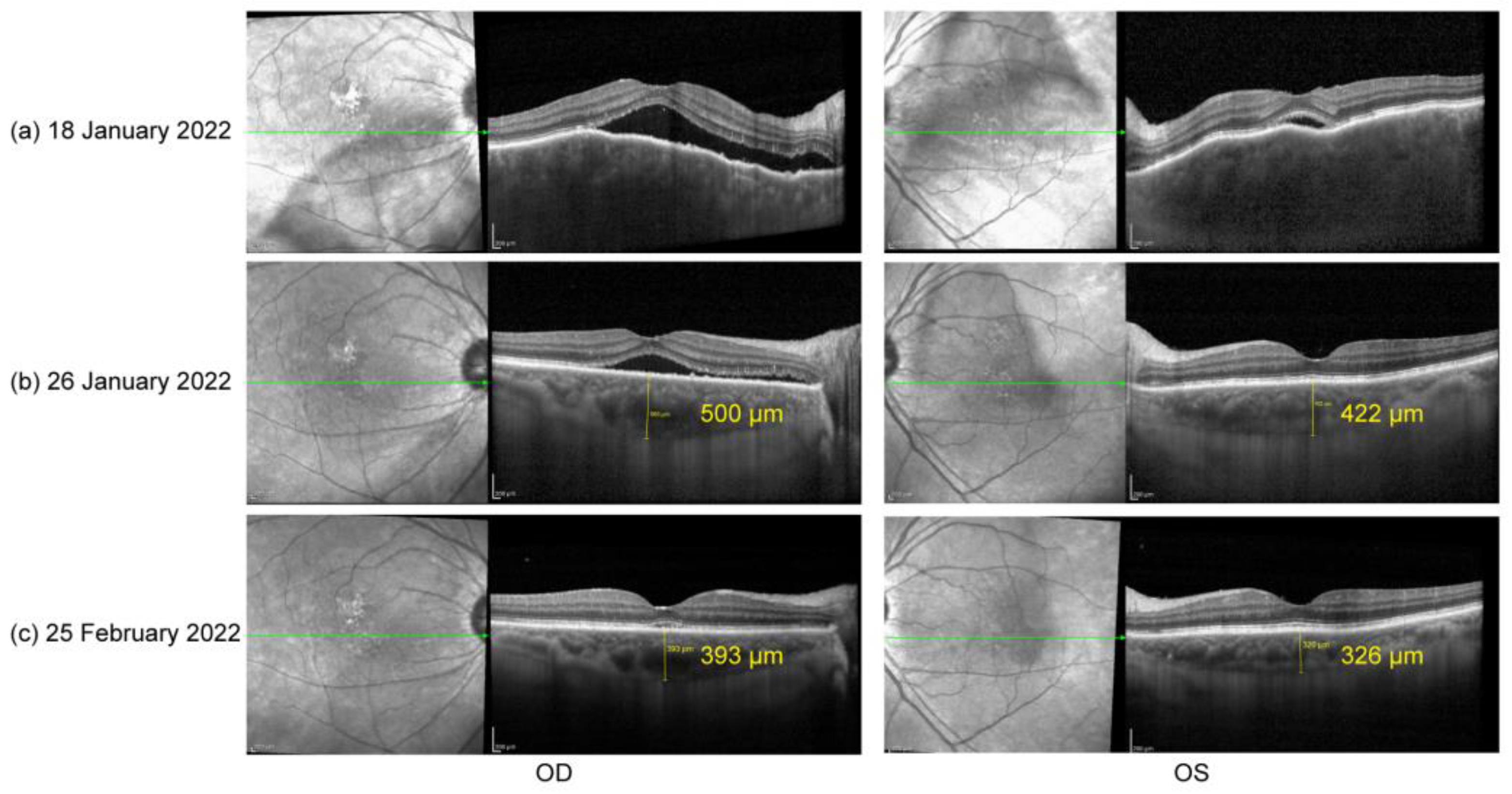 Vaccines 10 01792 g001 Vaccines 10 01792 g001
