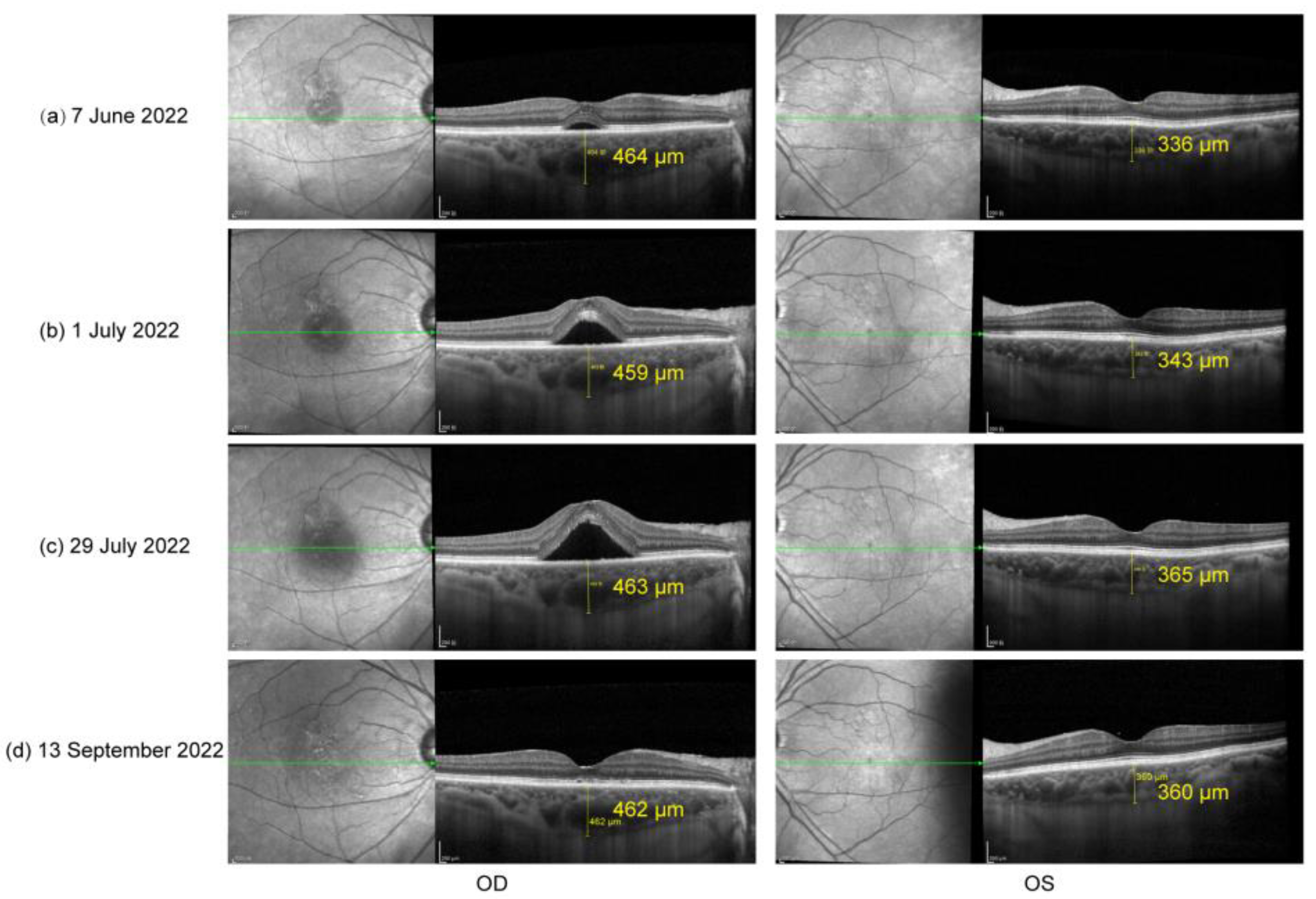 Vaccines 10 01792 g002 Vaccines 10 01792 g002