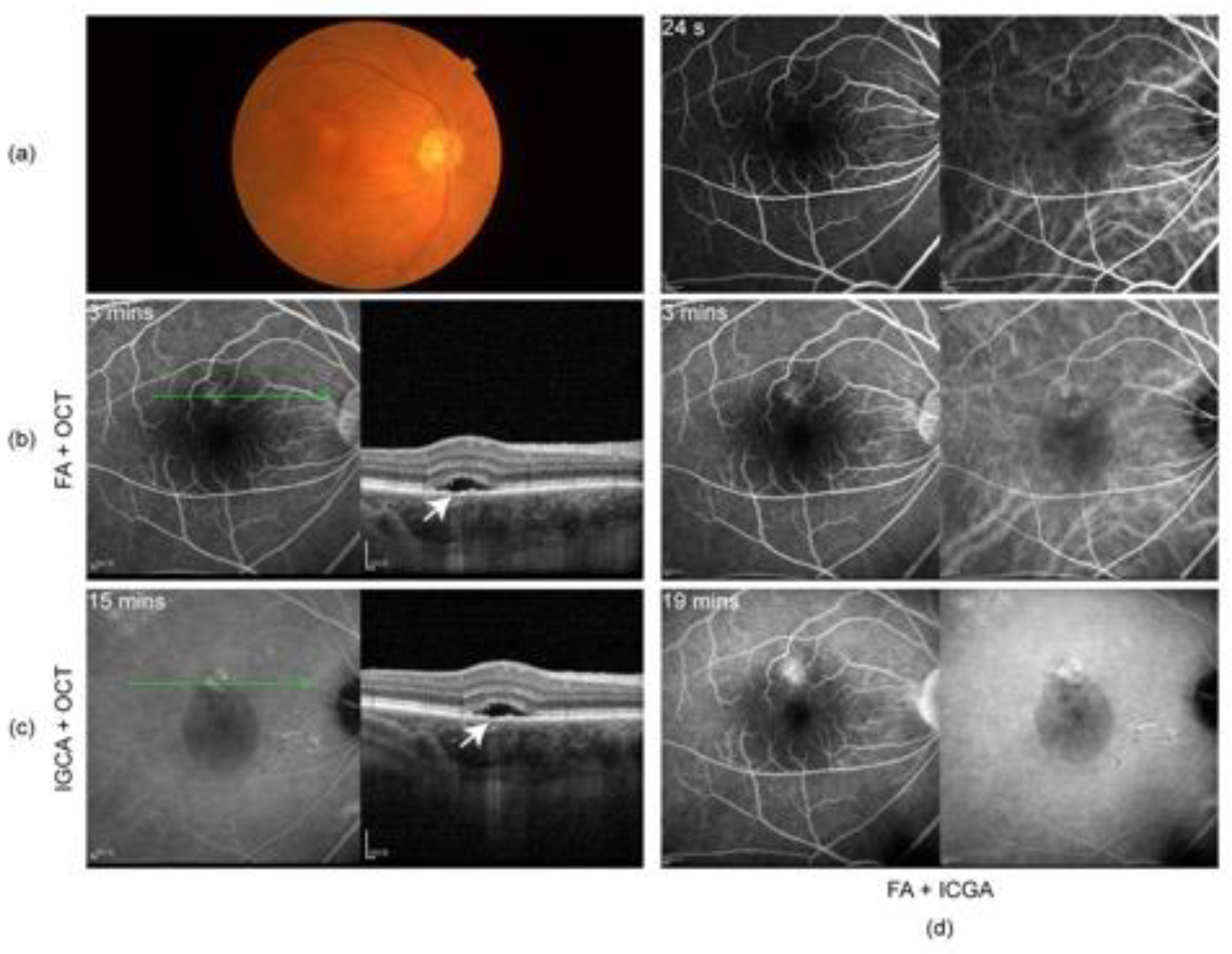 Vaccines 10 01792 g003 Vaccines 10 01792 g003