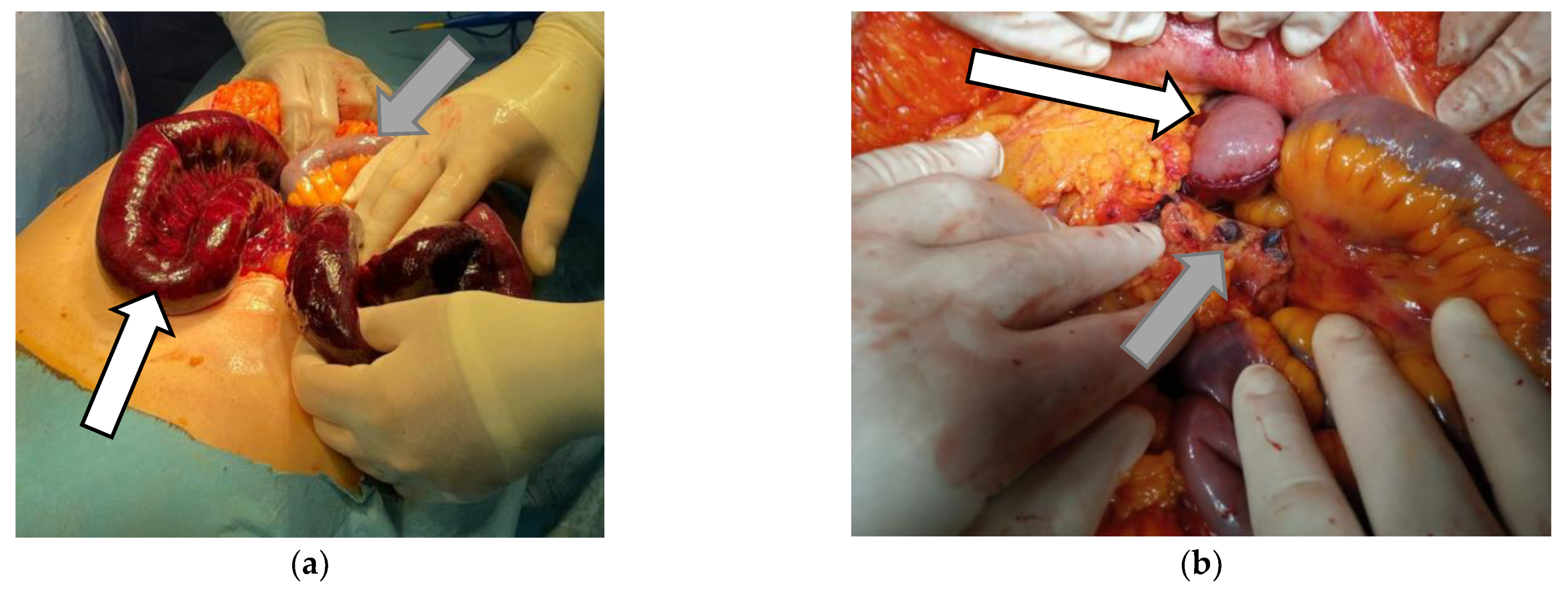 Vaccines 10 01950 g004