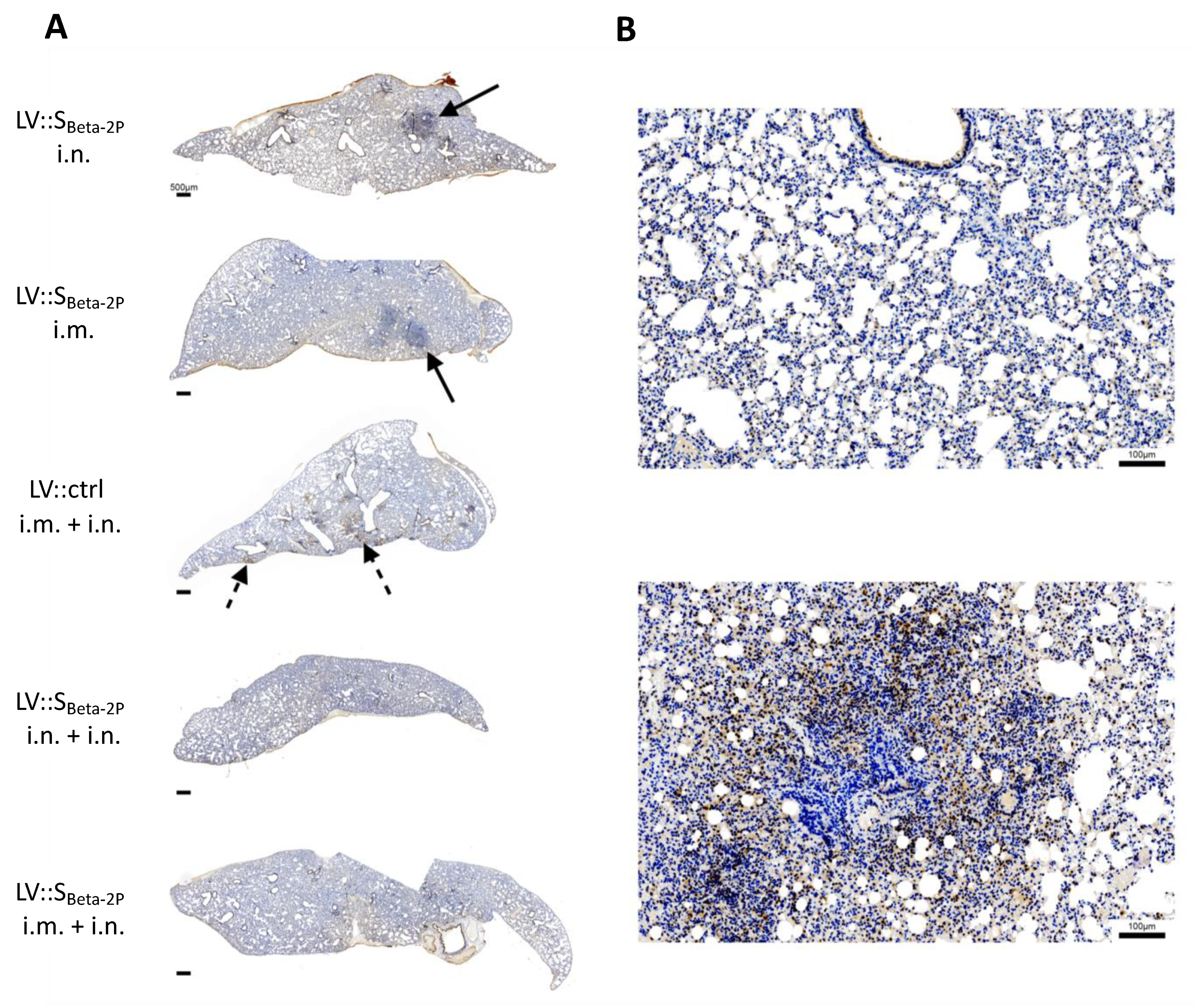 Vaccines 11 00012 g006