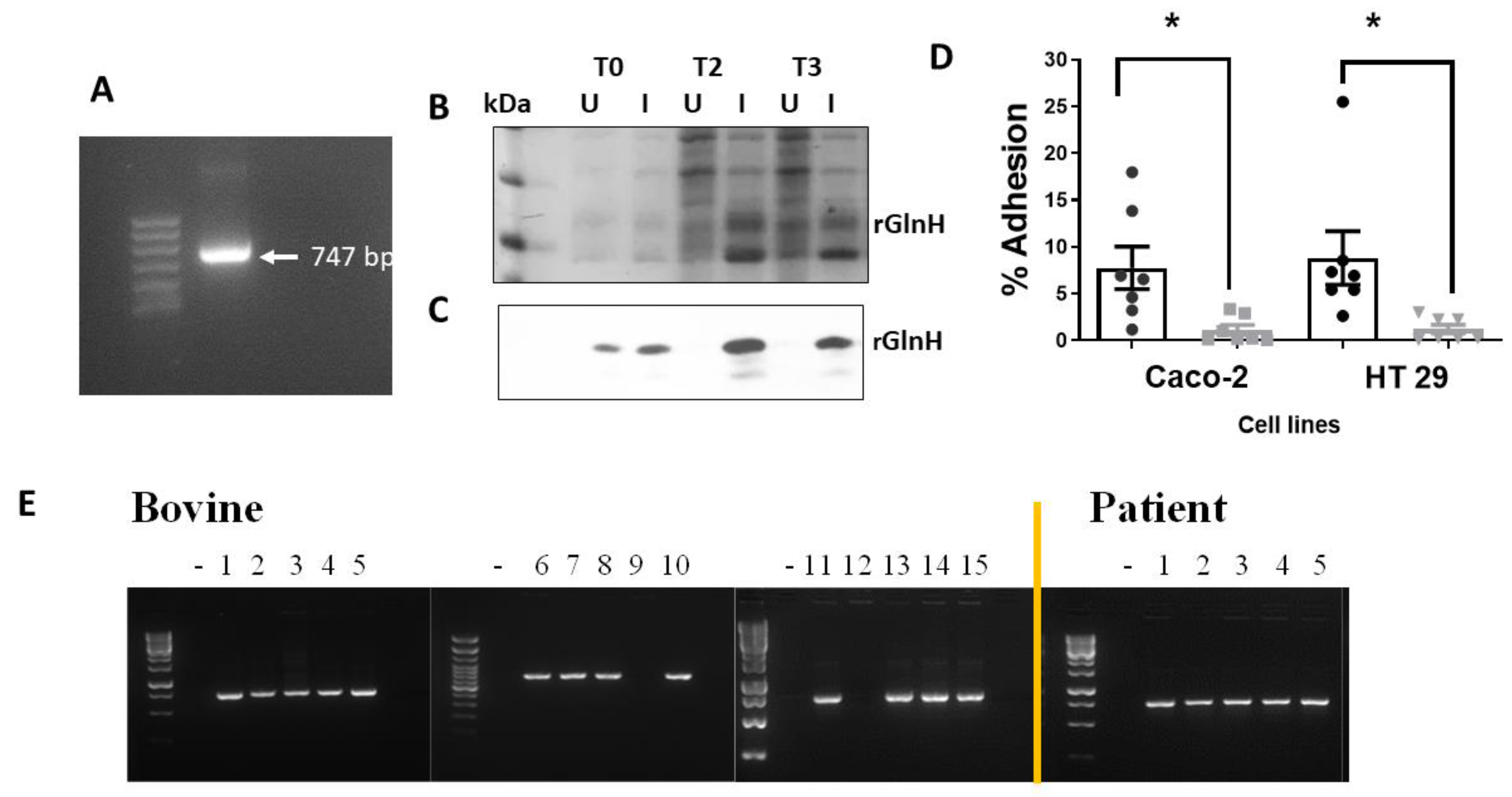 Vaccines 11 00175 g002