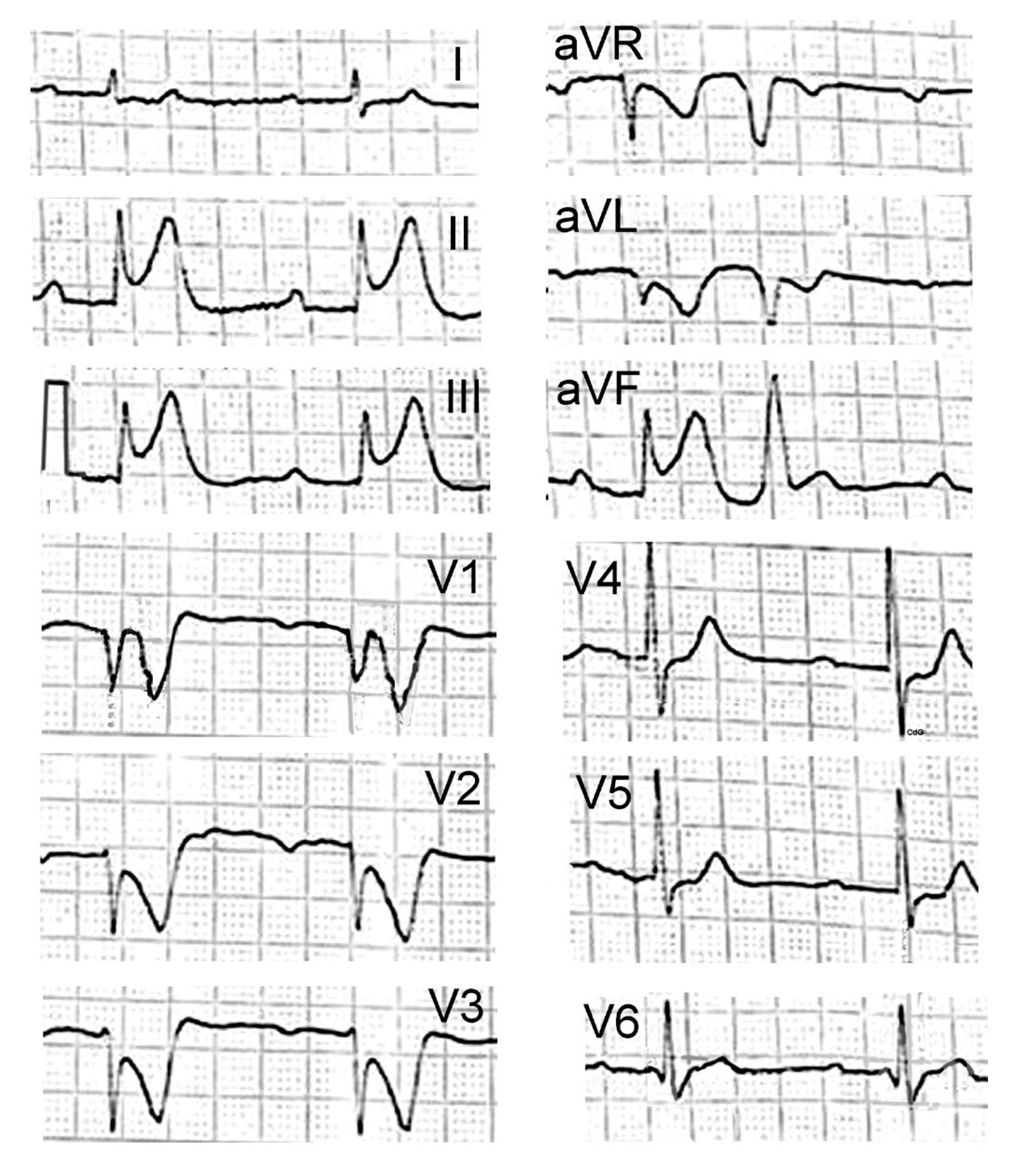 Vaccines 11 00220 g002 Vaccines 11 00220 g002