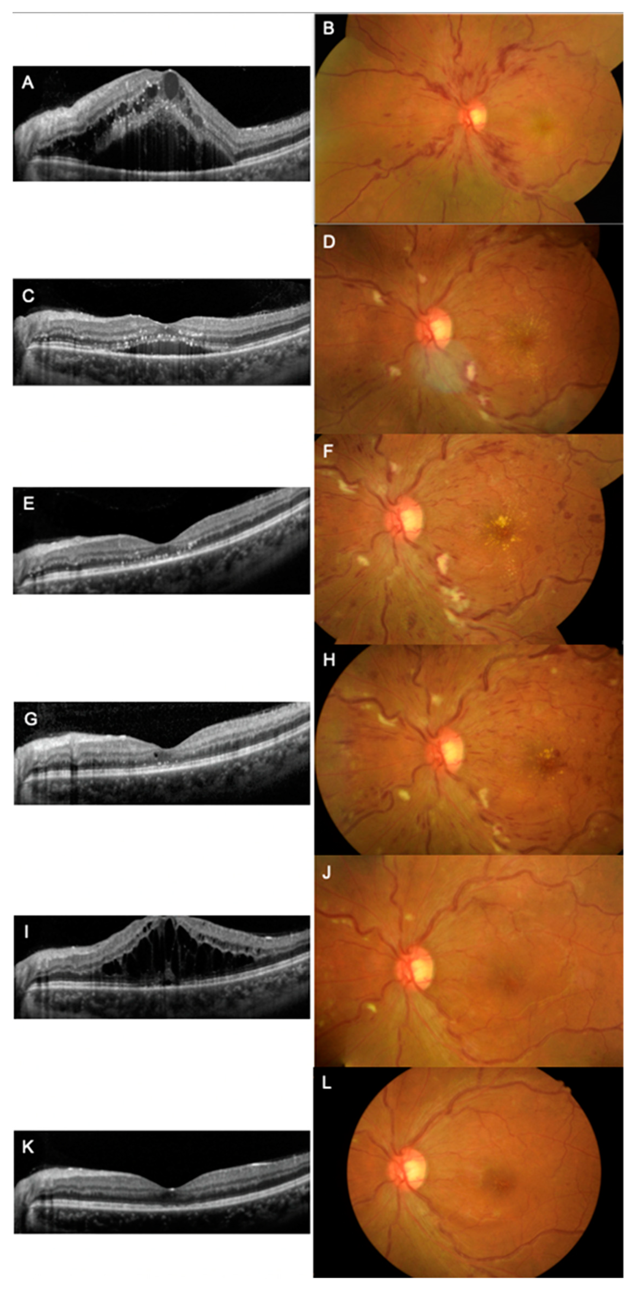 Vaccines 11 00365 g001