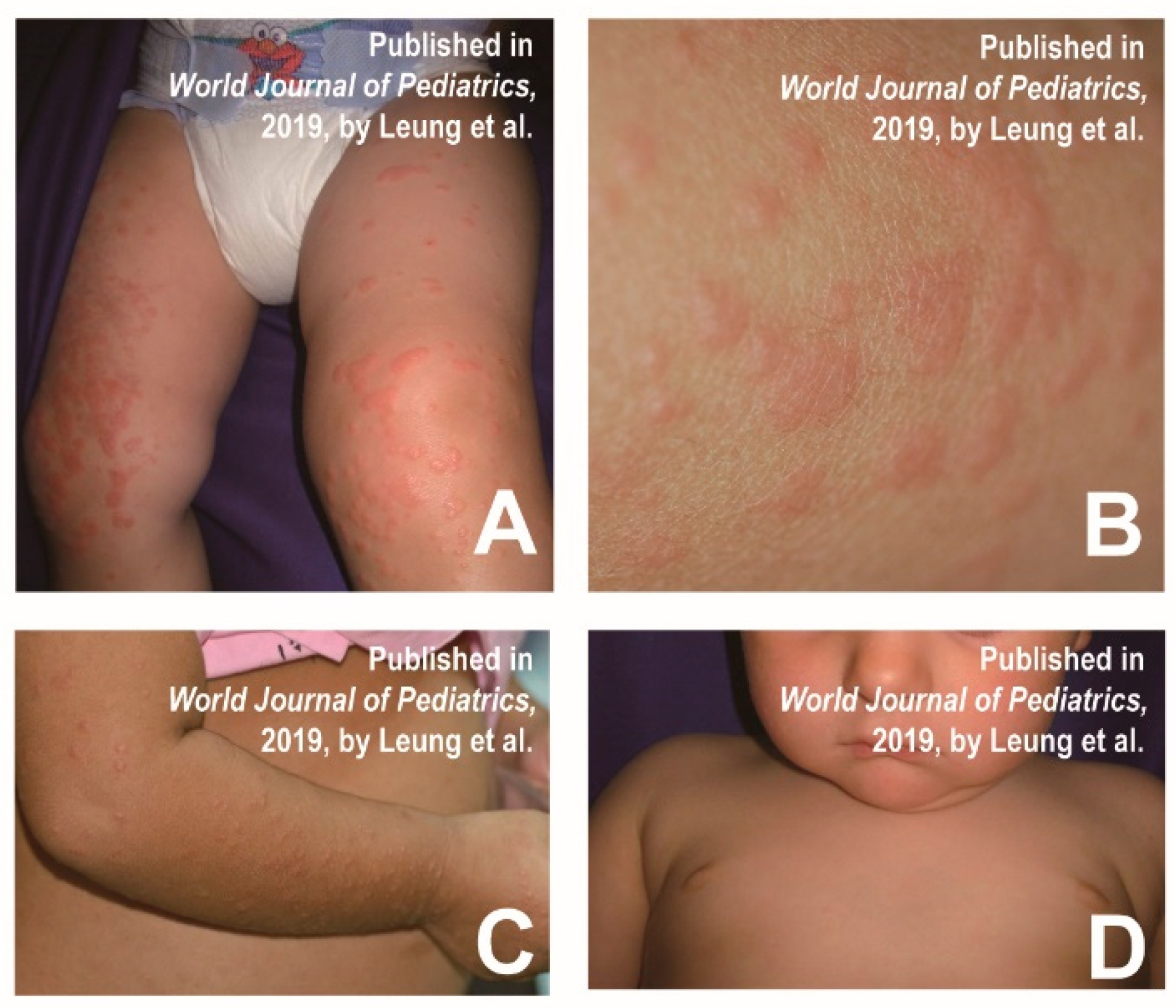 Vaccines 11 00405 g001