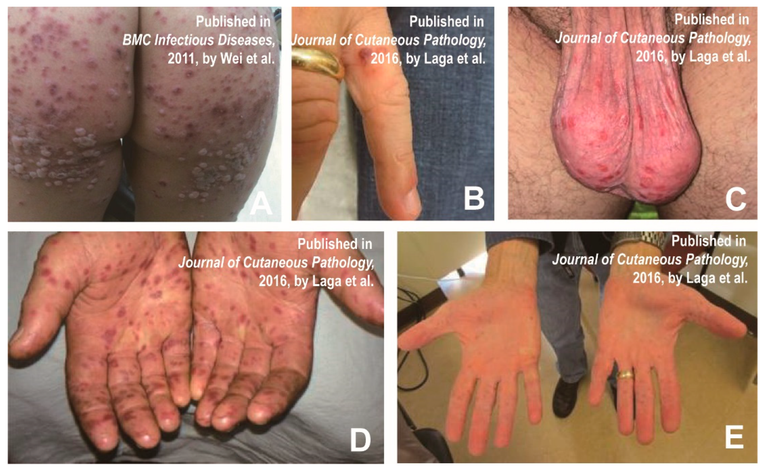 Vaccines 11 00405 g003