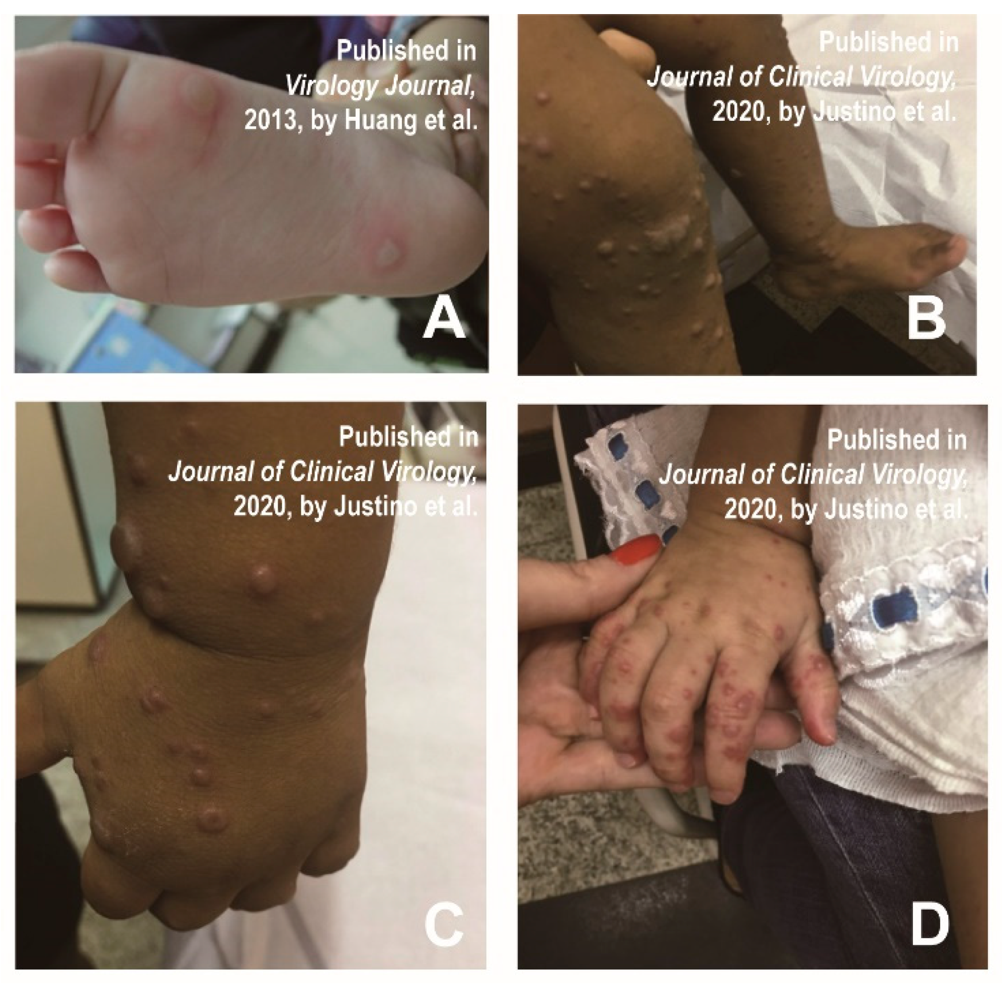 Vaccines 11 00405 g004