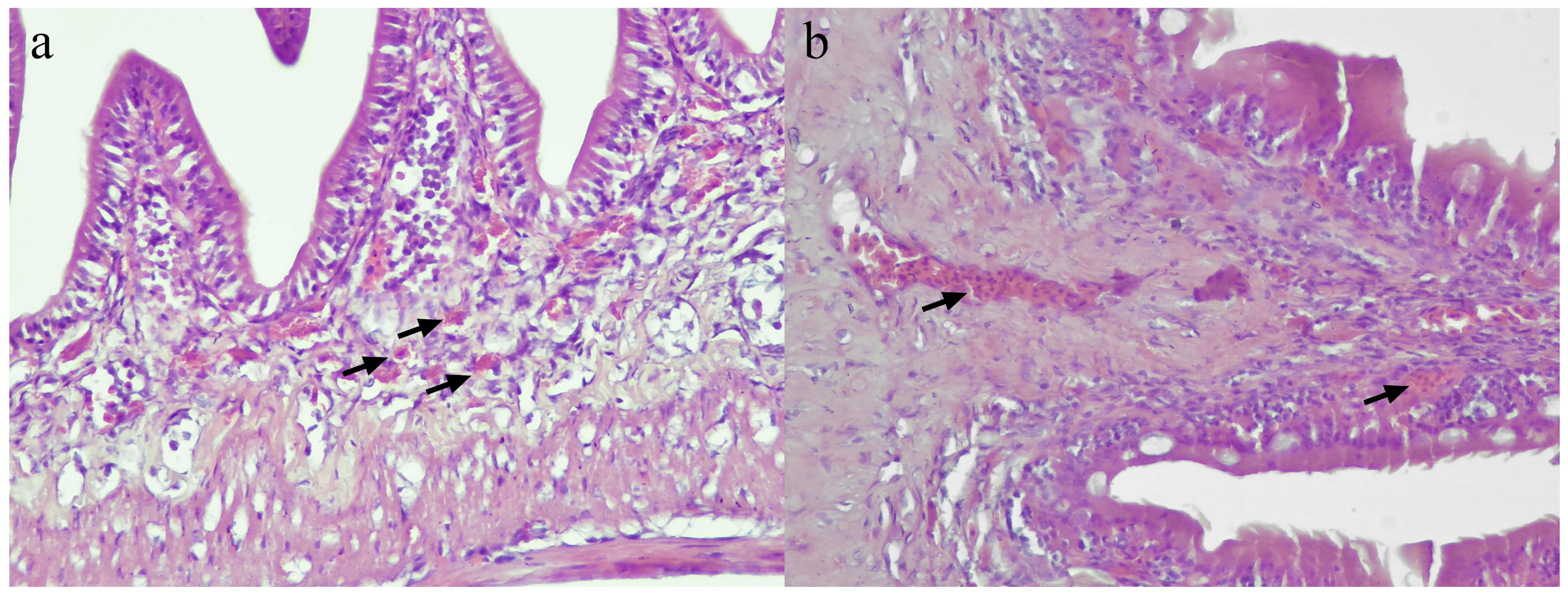 Vaccines 11 00602 g005