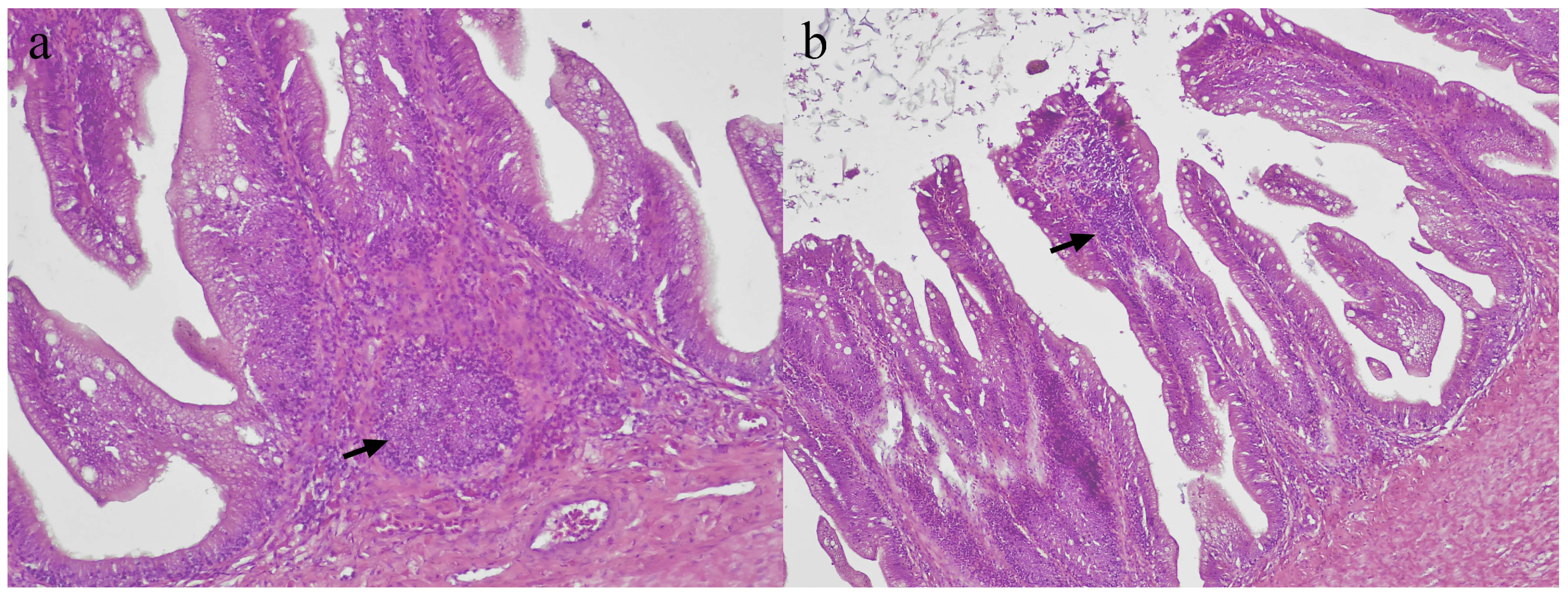 Vaccines 11 00602 g006